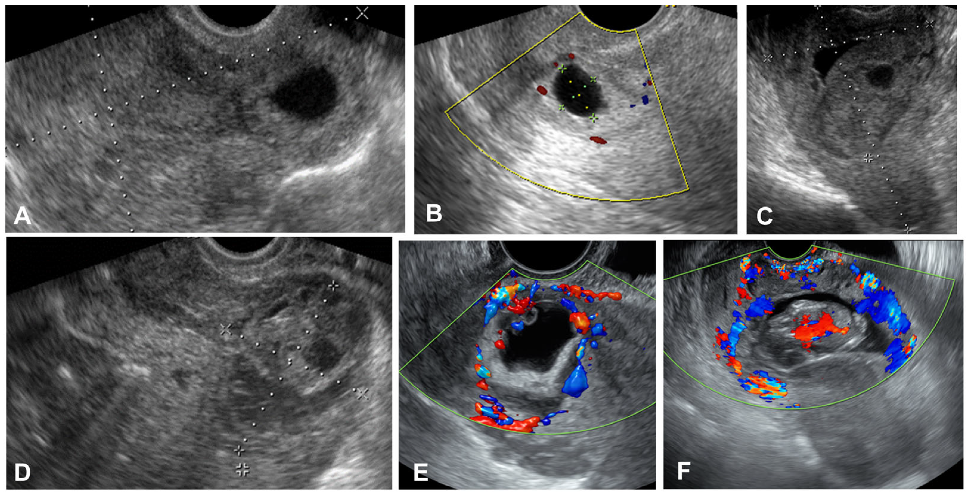 Diagnostics 15 00965 g001