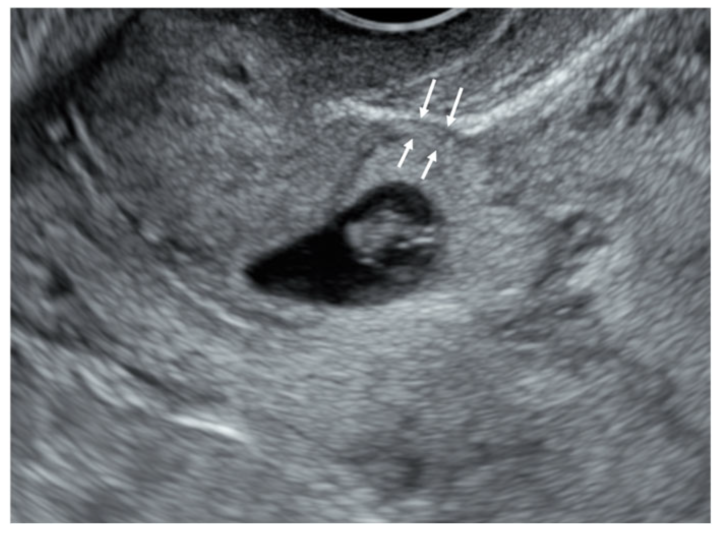 Diagnostics 15 00965 g002