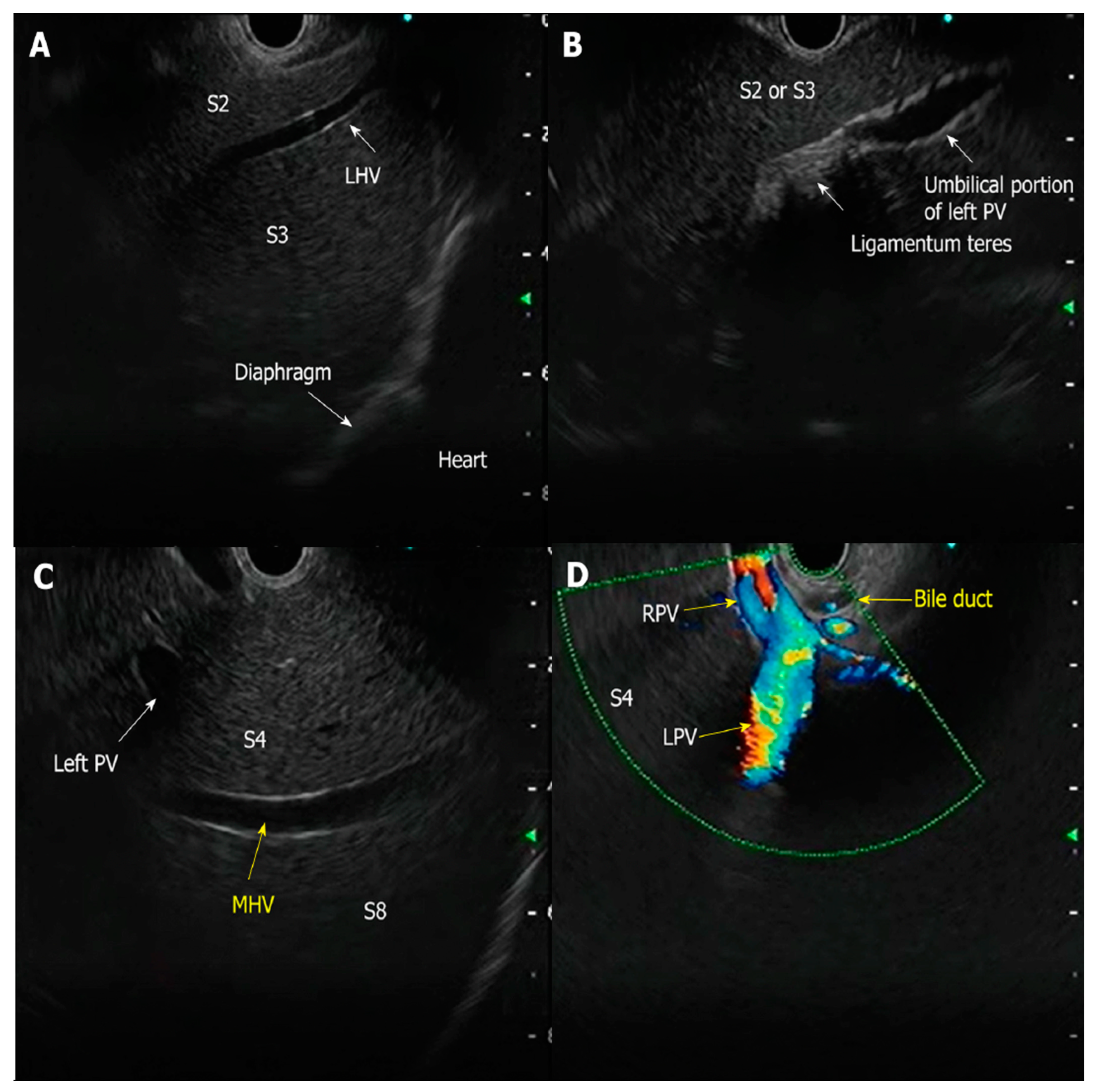 Diagnostics 15 00967 g001