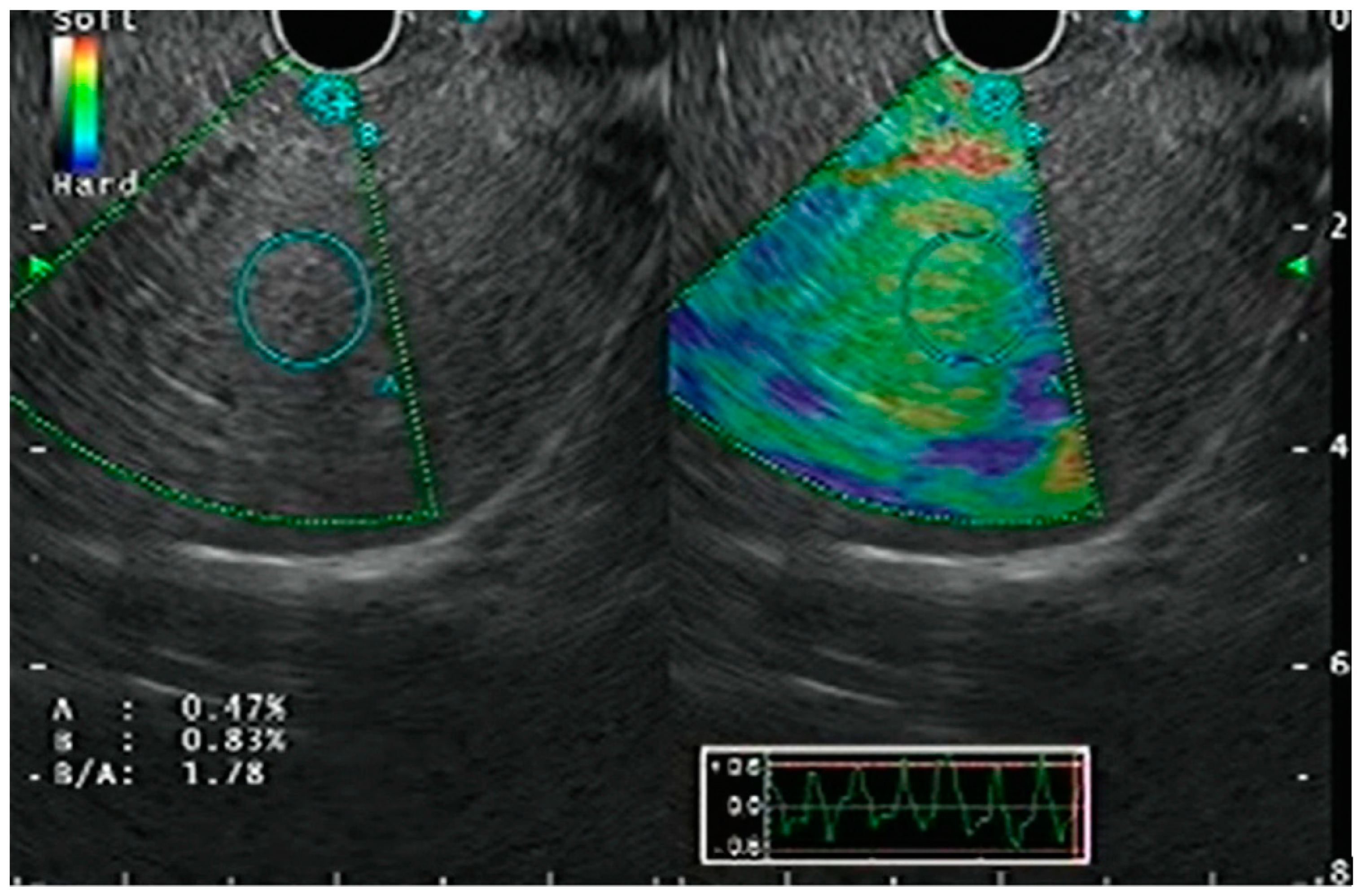 Diagnostics 15 00967 g002