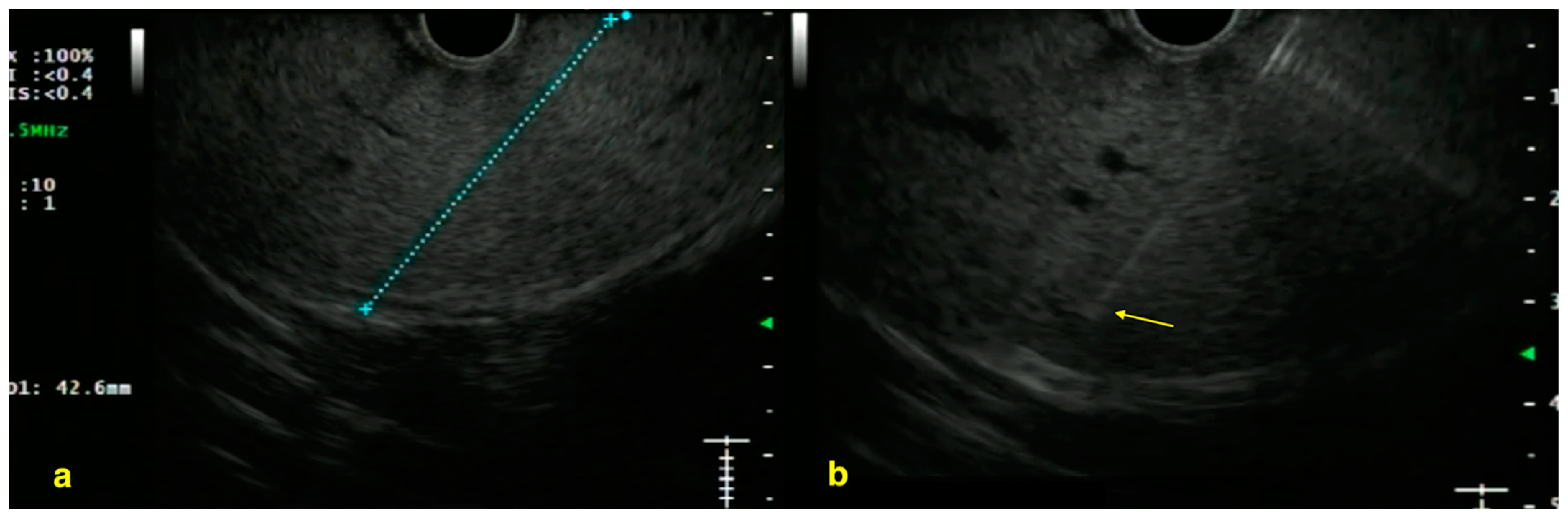Diagnostics 15 00967 g003