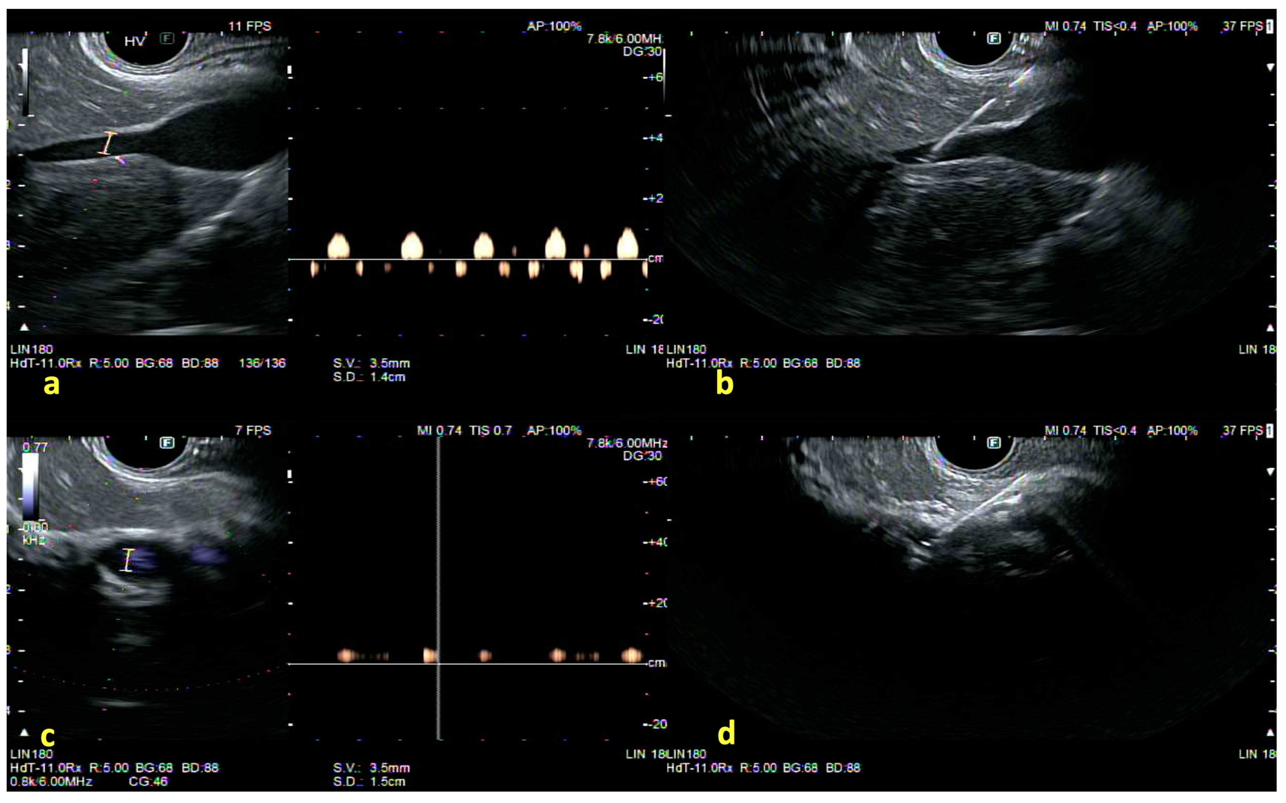 Diagnostics 15 00967 g004