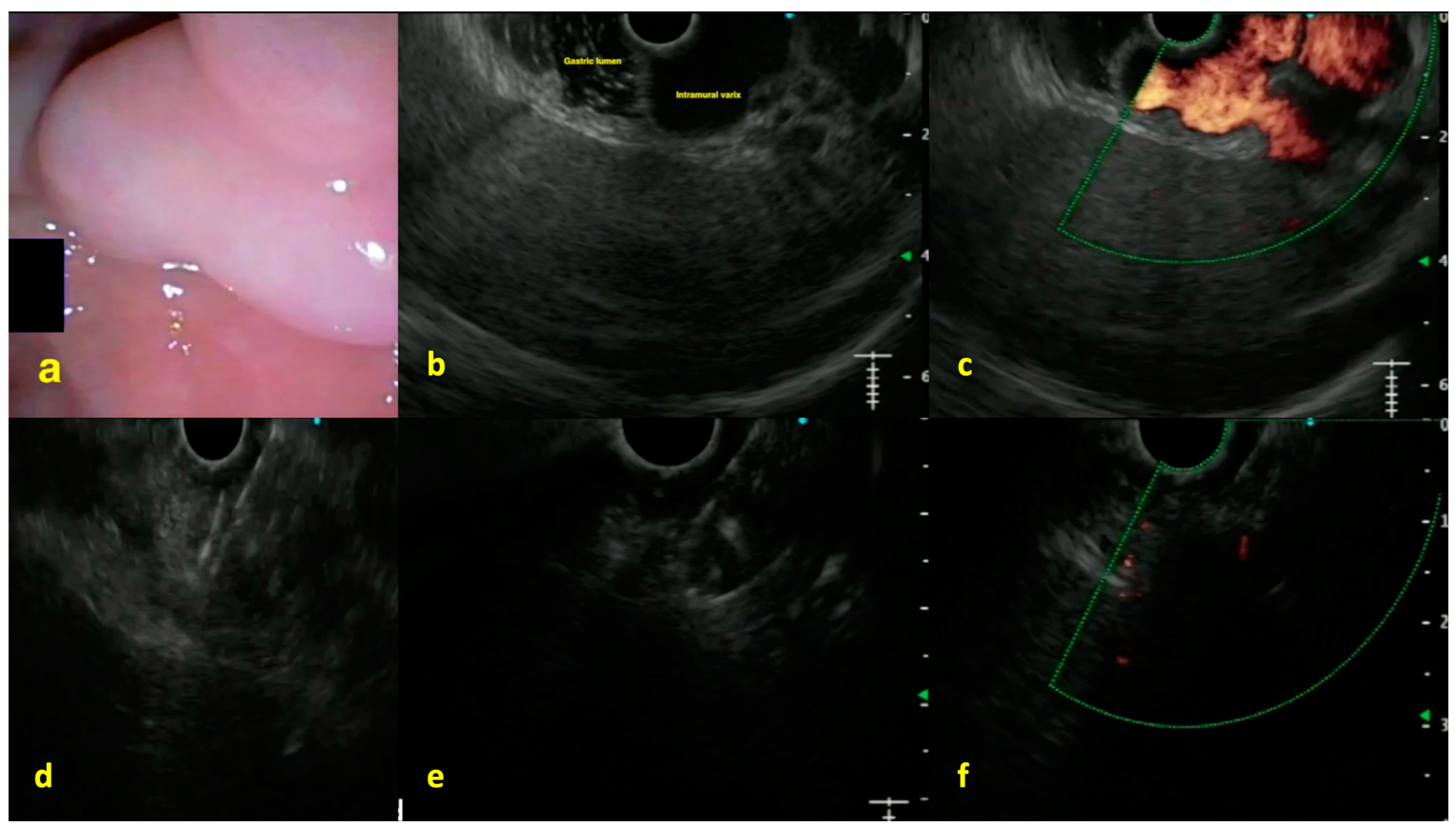 Diagnostics 15 00967 g005