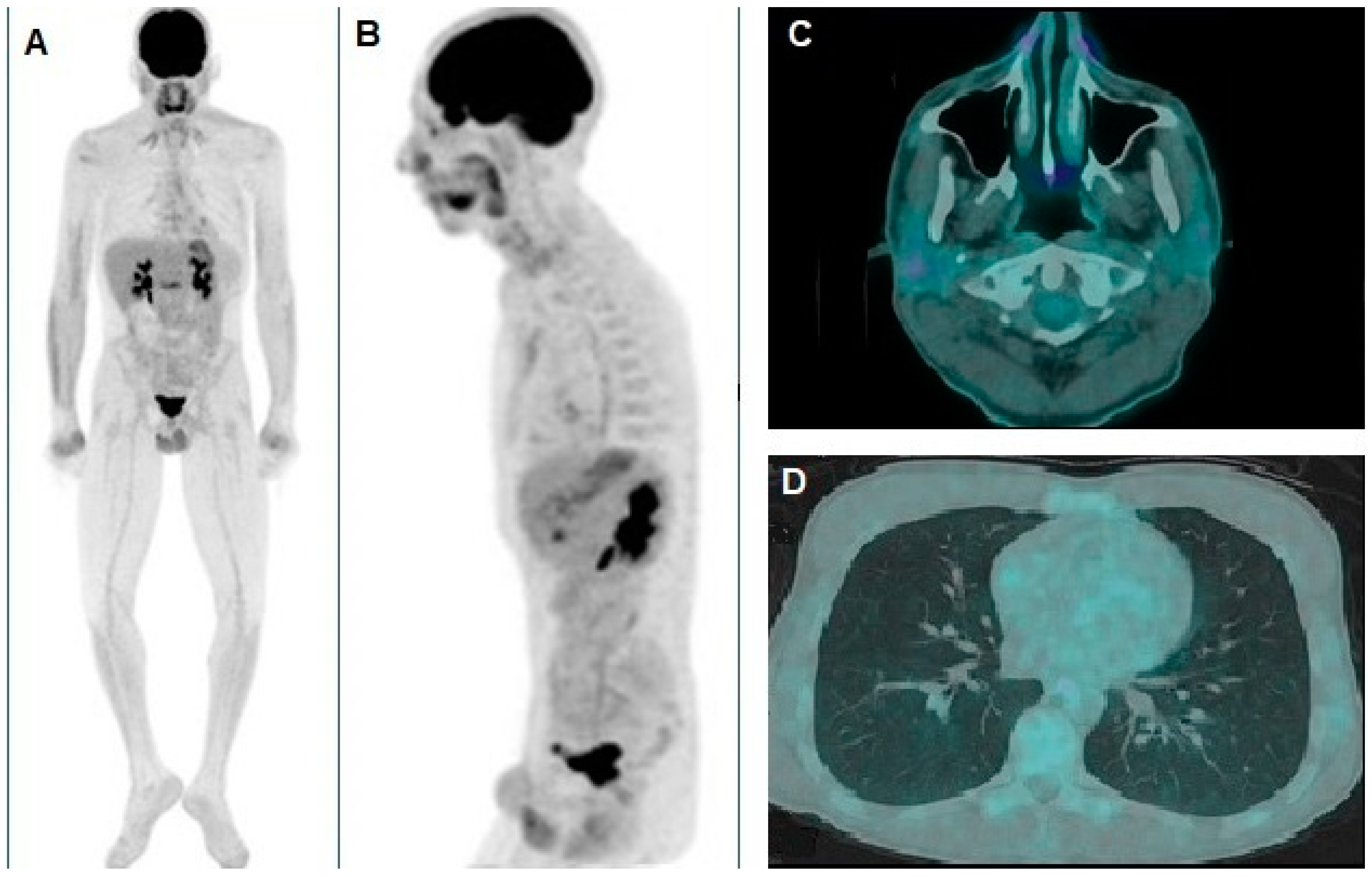 Diagnostics 15 00979 g004