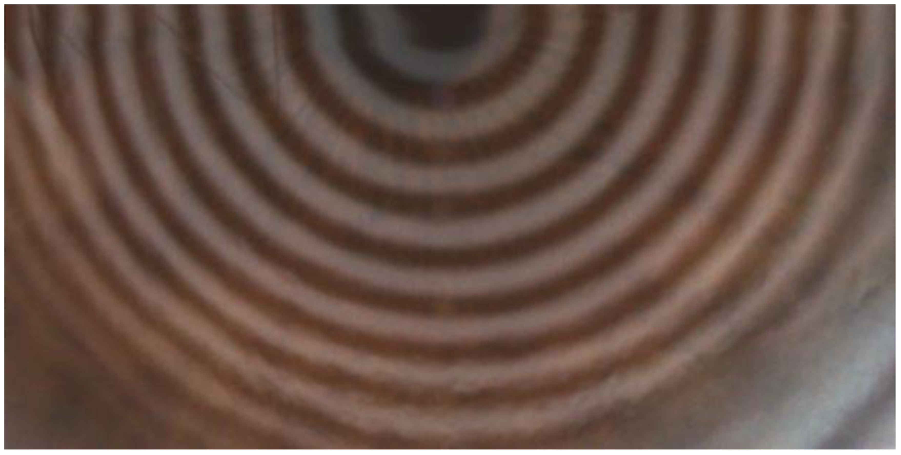 Diagnostics 15 00981 g002