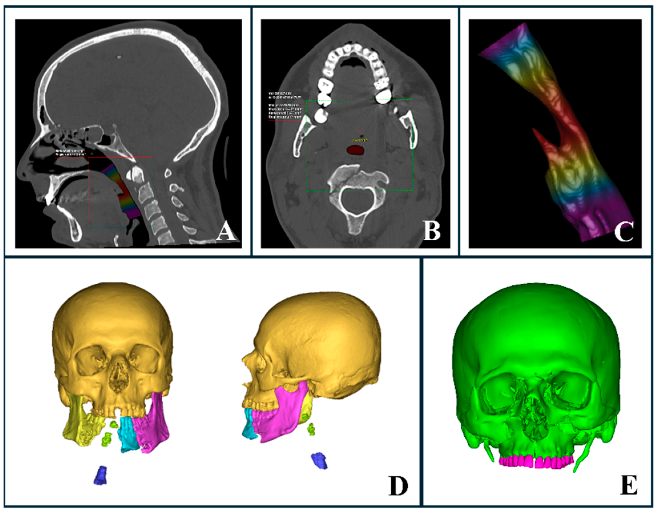 Diagnostics 15 00984 g004