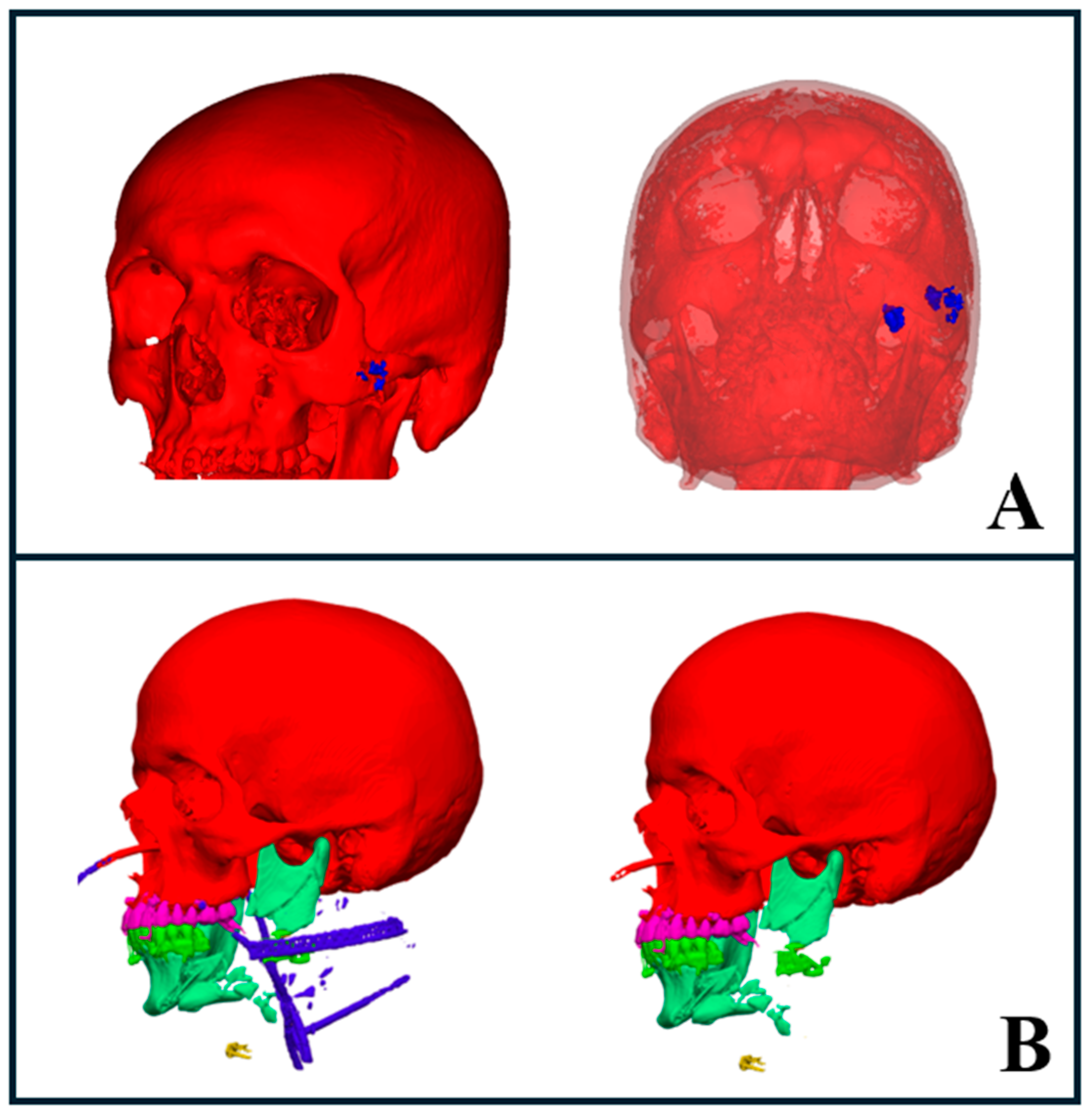 Diagnostics 15 00984 g006