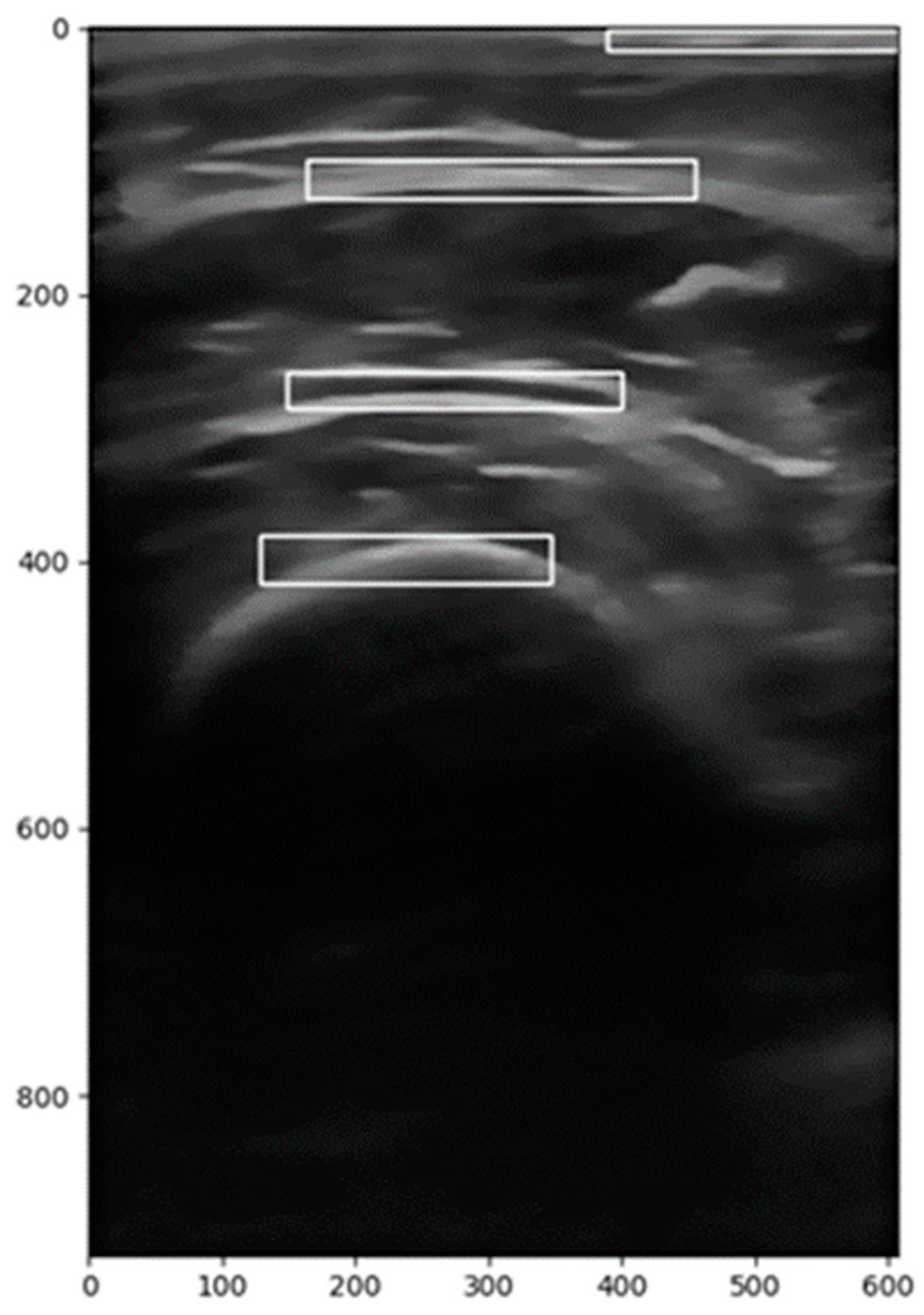 Diagnostics 15 00988 g001