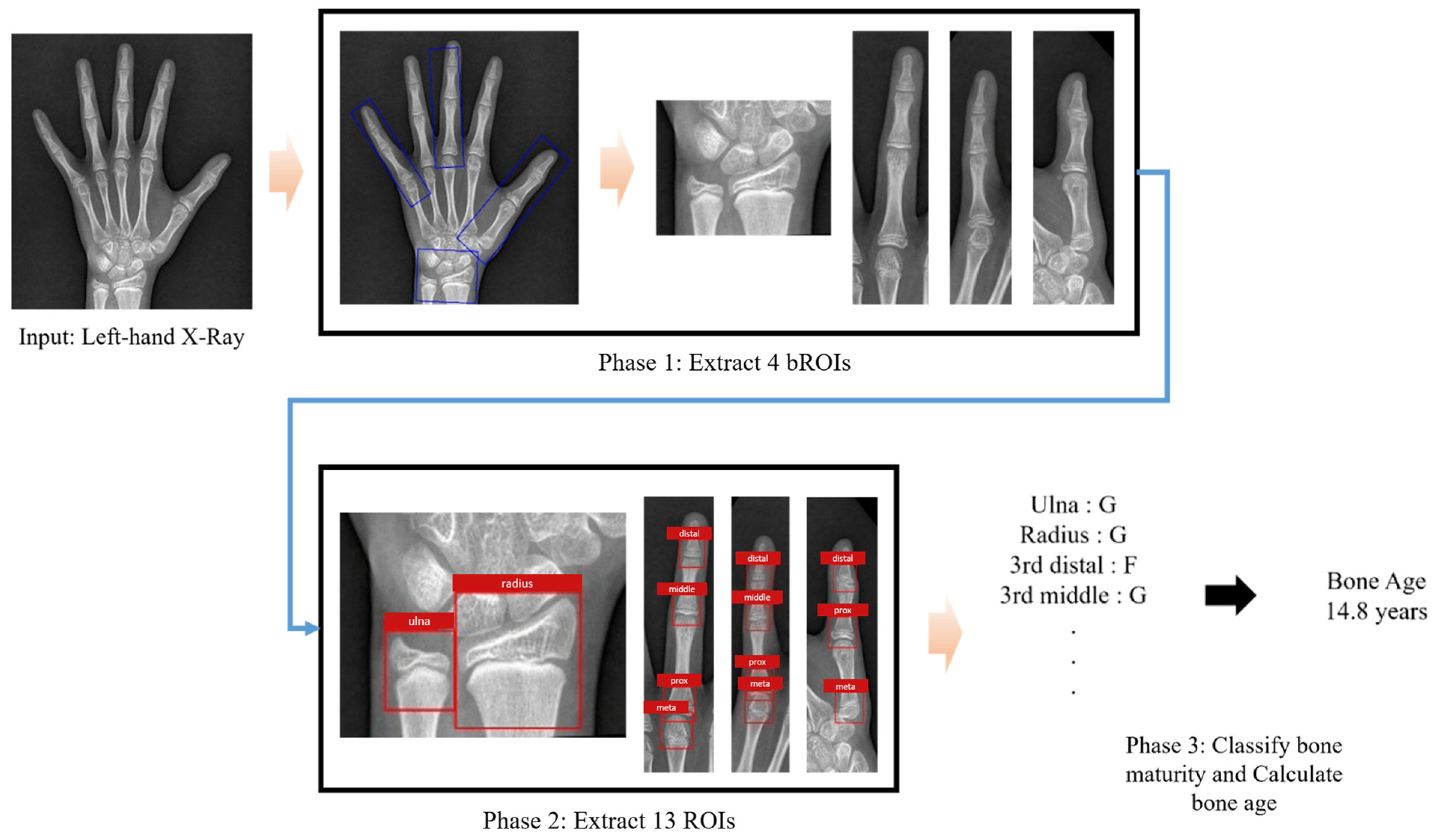 Diagnostics 15 00993 g0a1