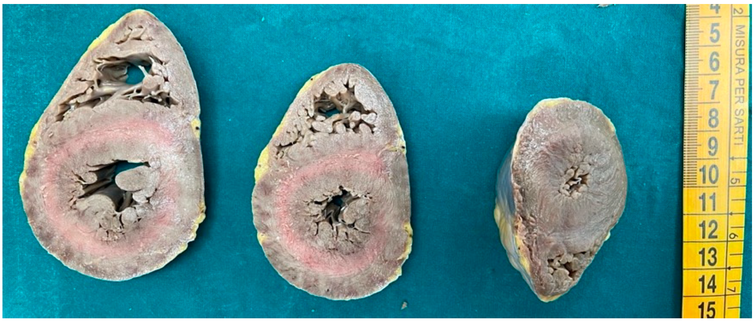 Diagnostics 15 00999 g001 Diagnostics 15 00999 g001