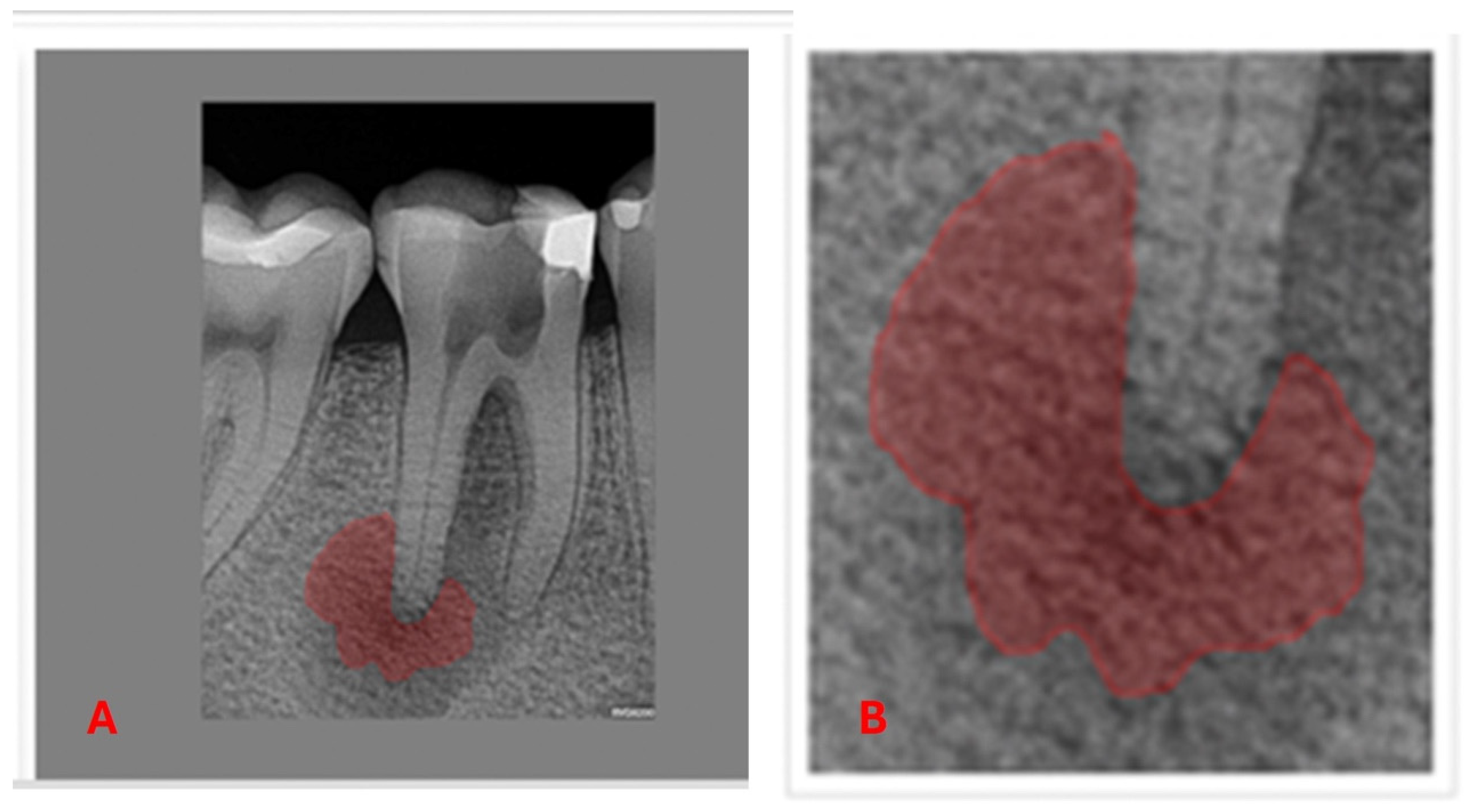 Diagnostics 15 01009 g003
