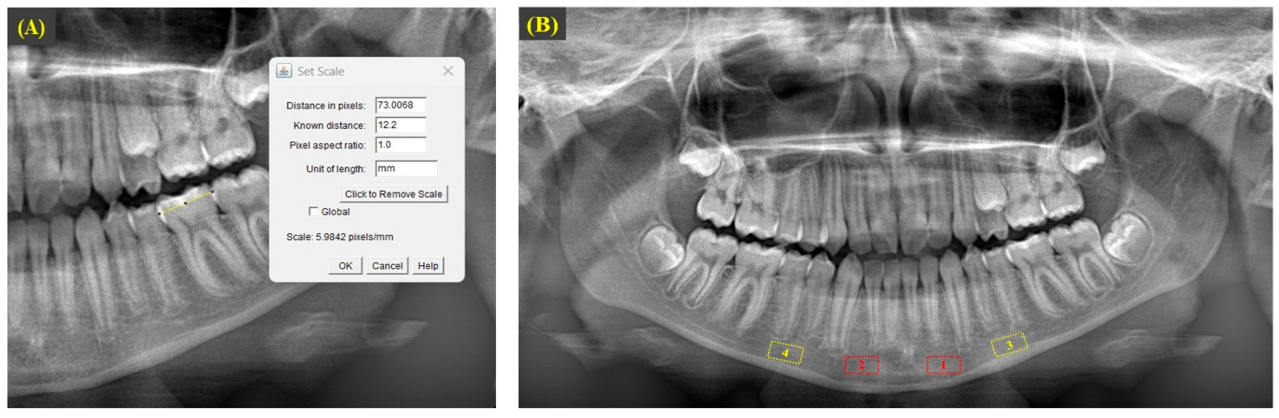 Diagnostics 15 01013 g001