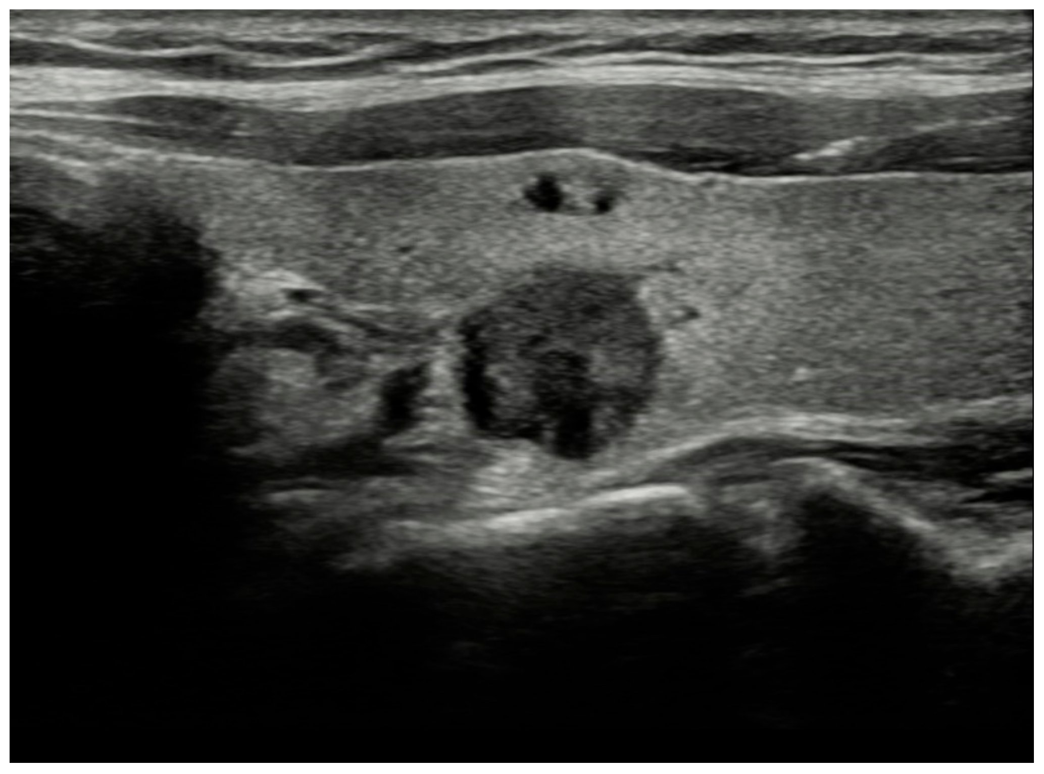 Diagnostics 15 01015 g002