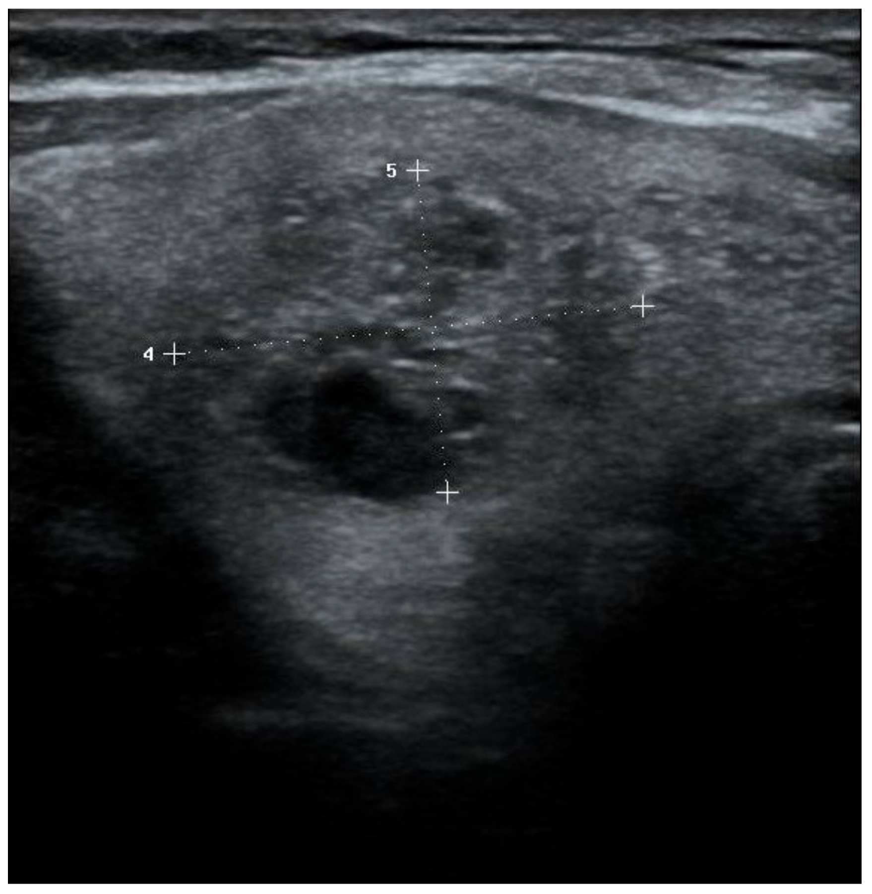 Diagnostics 15 01015 g003