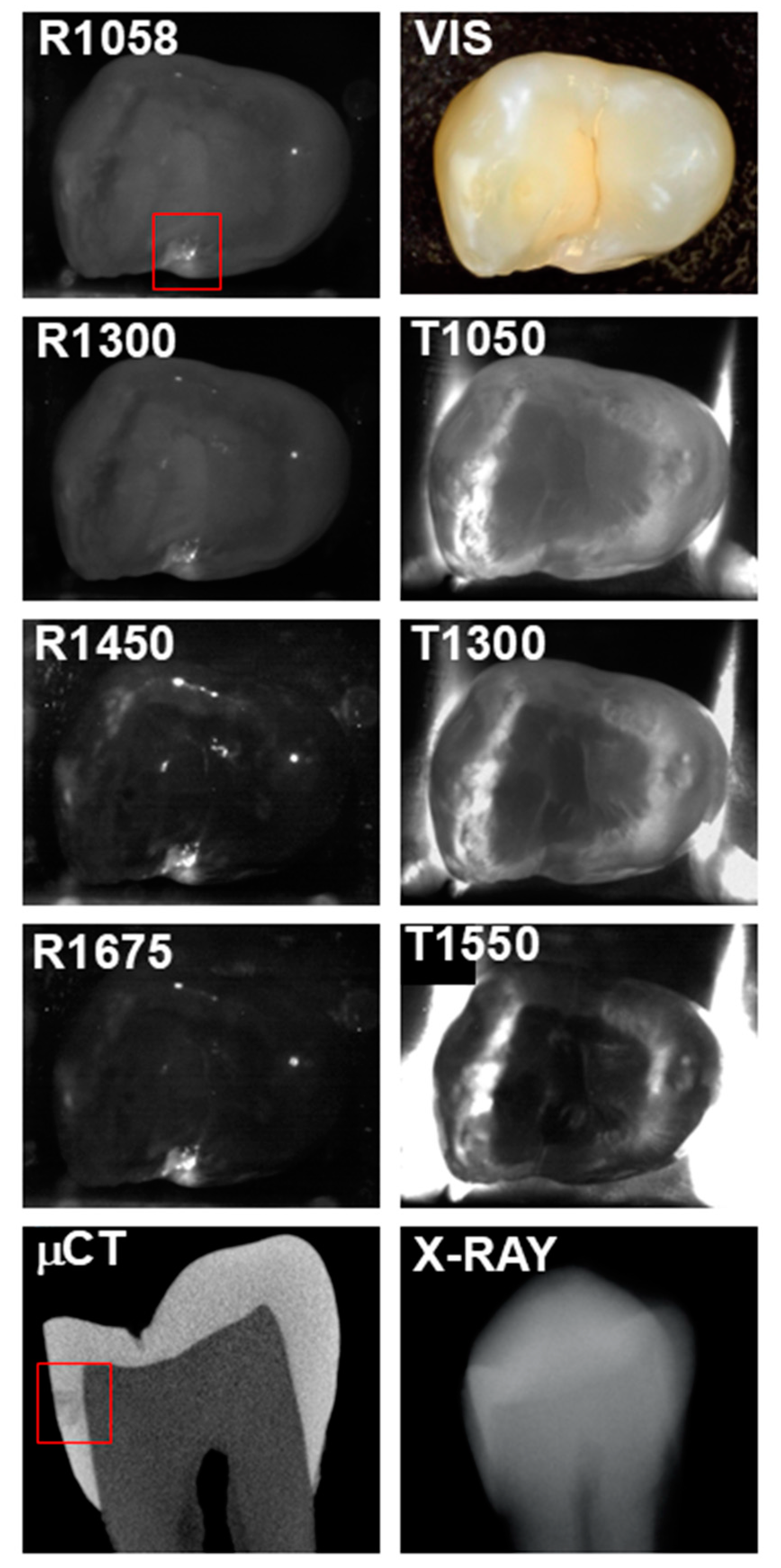 Diagnostics 15 01034 g002