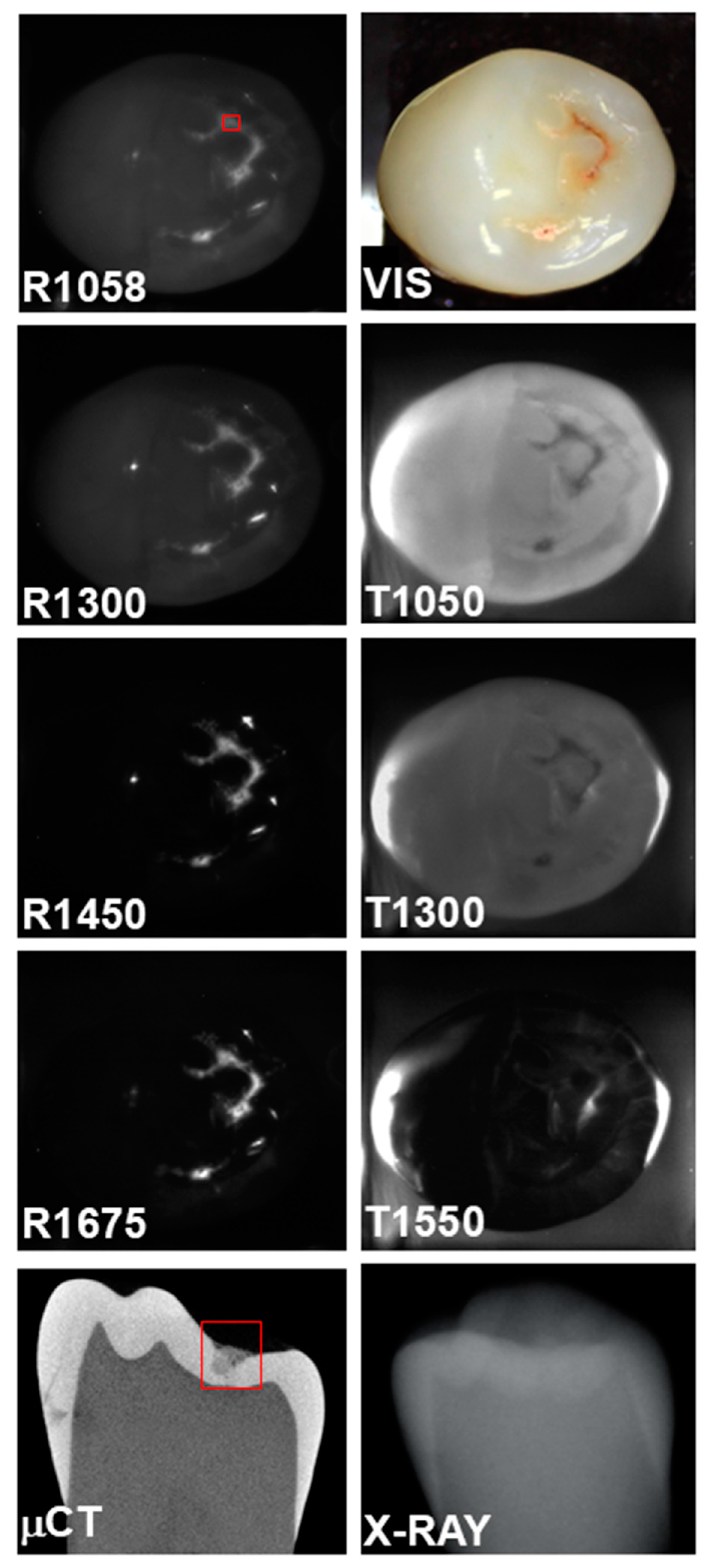 Diagnostics 15 01034 g003
