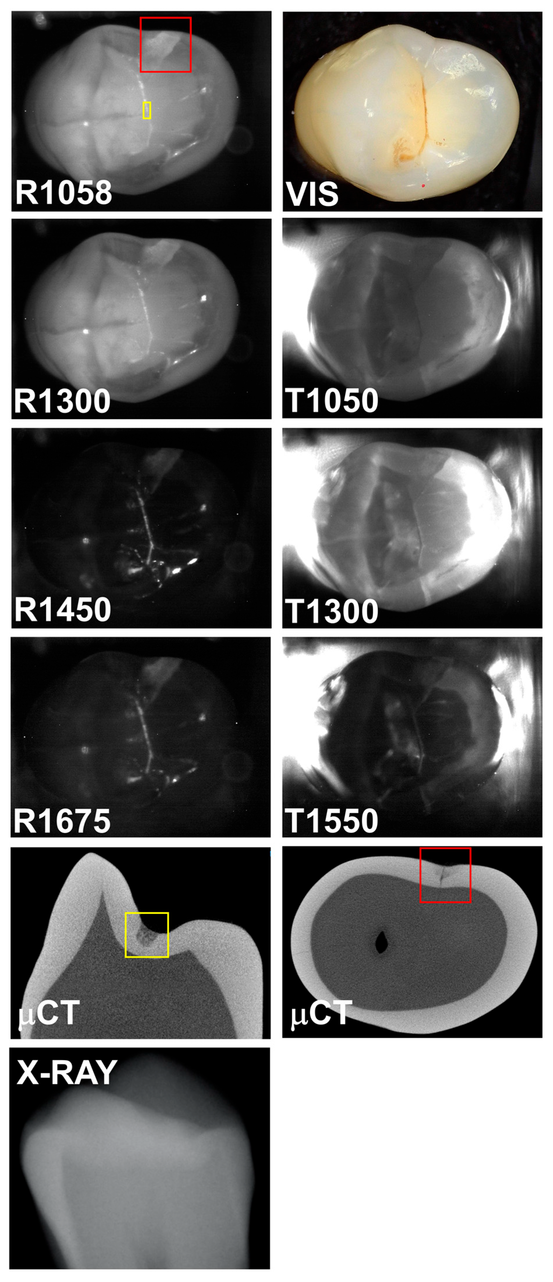 Diagnostics 15 01034 g004