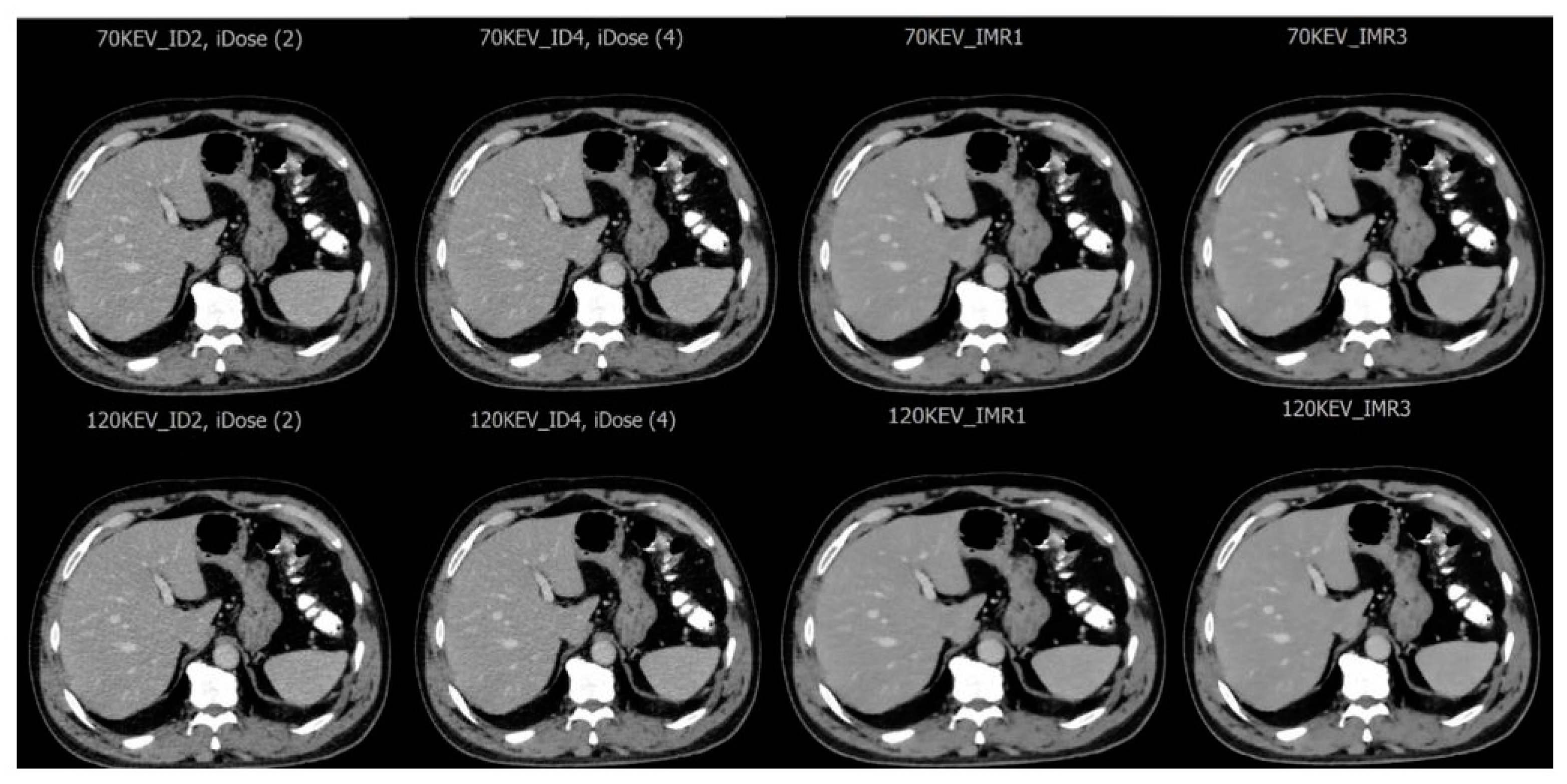 Diagnostics 15 01043 g001