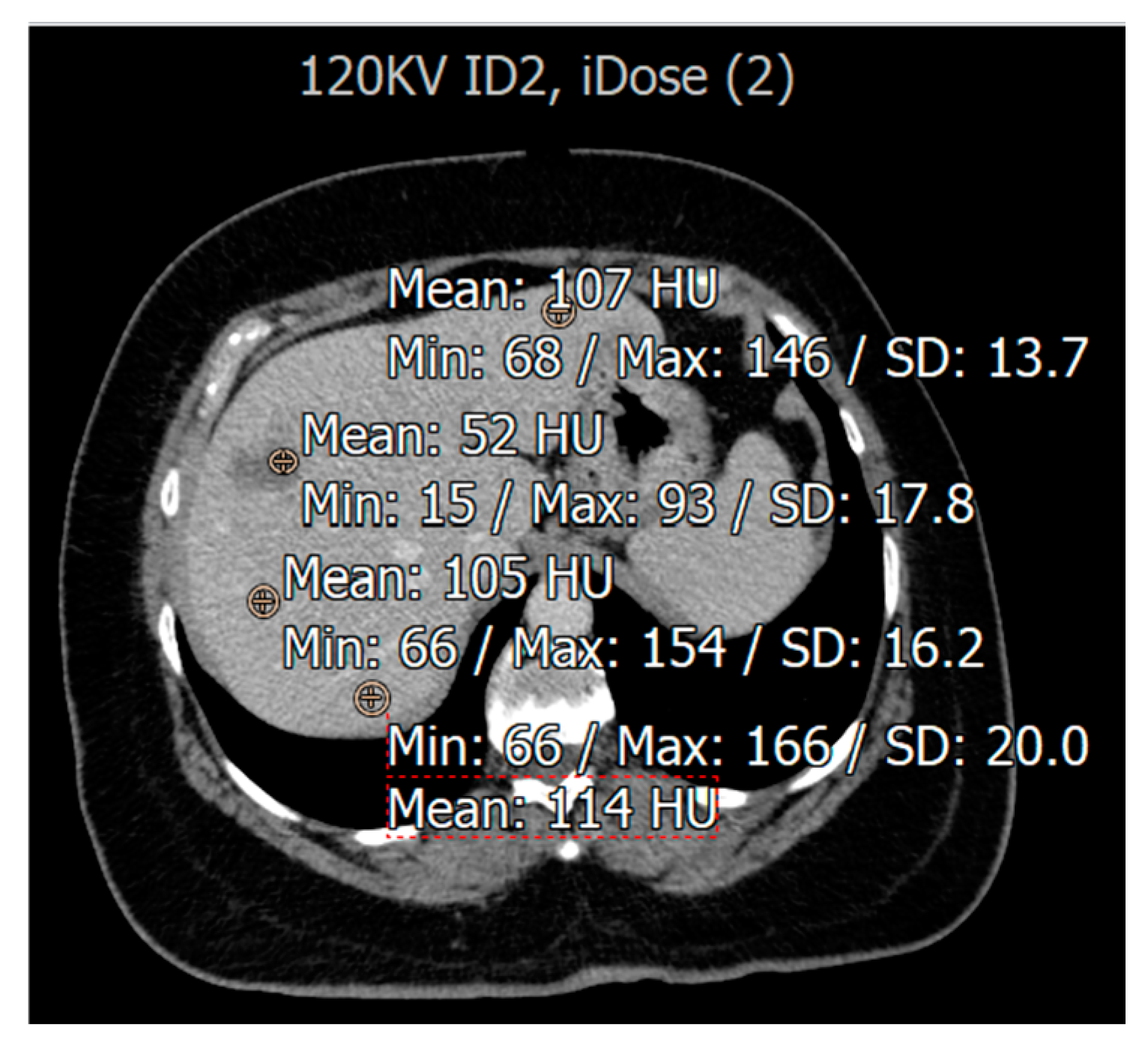 Diagnostics 15 01043 g002