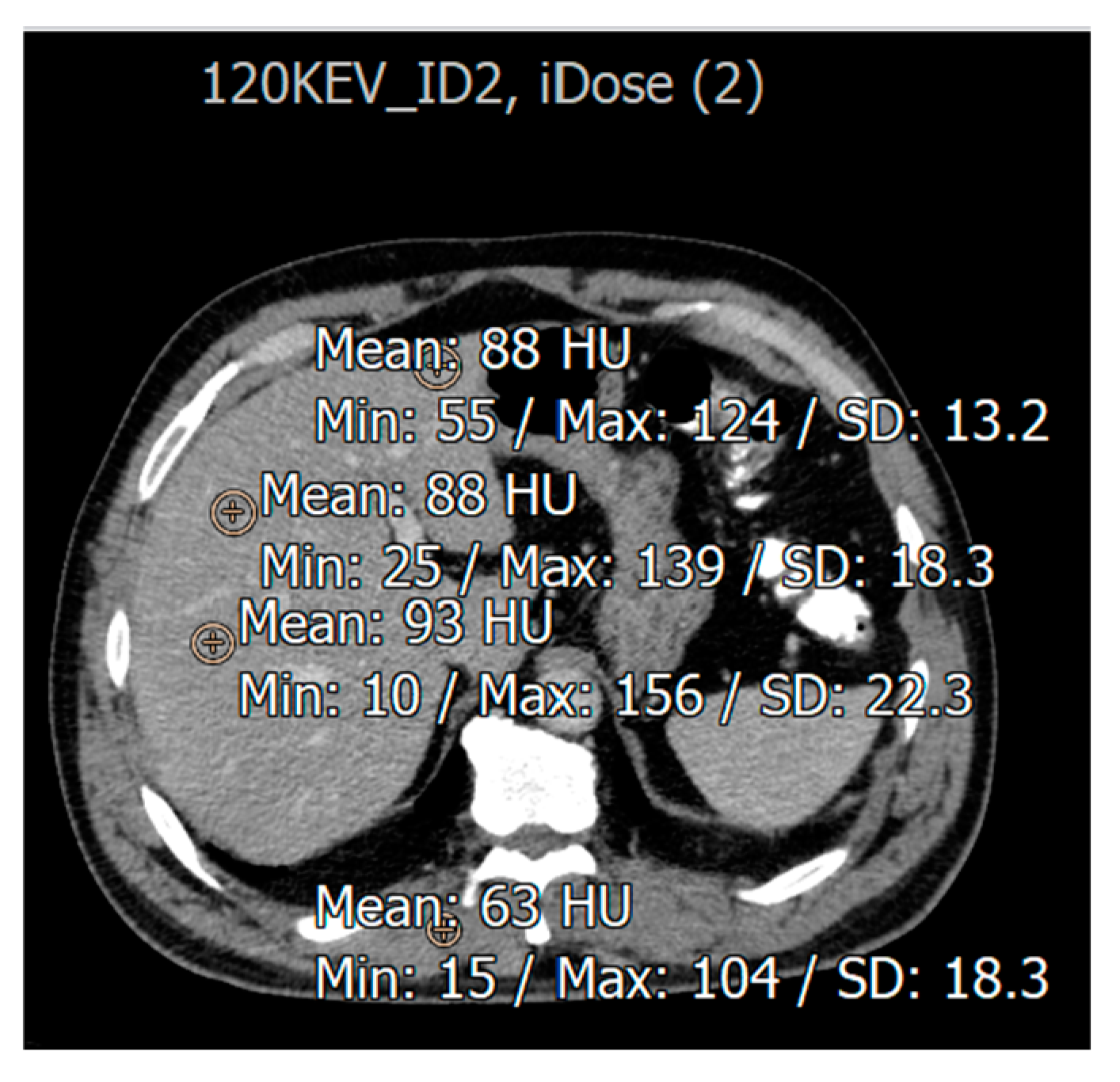 Diagnostics 15 01043 g003