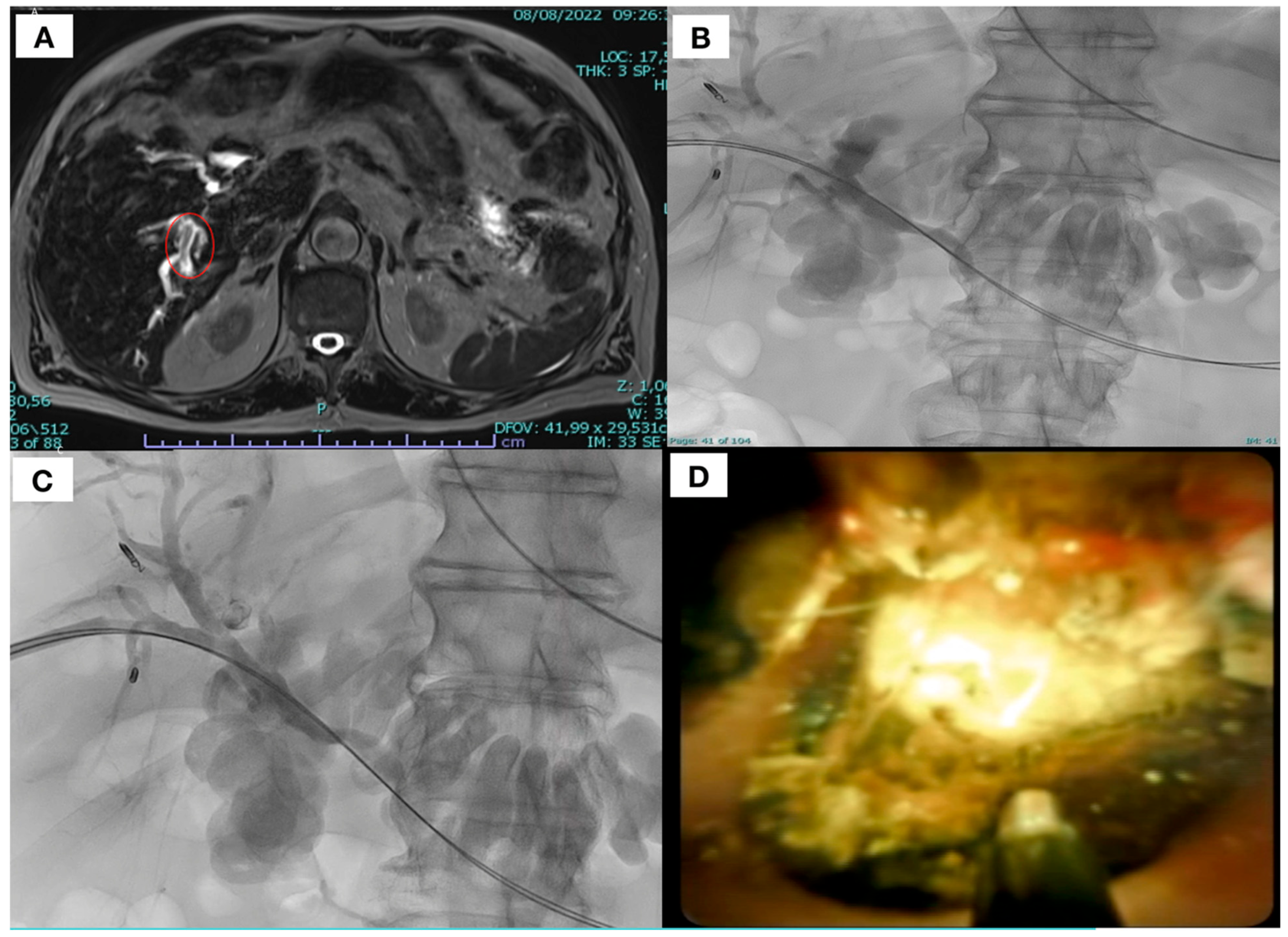Diagnostics 15 01060 g002