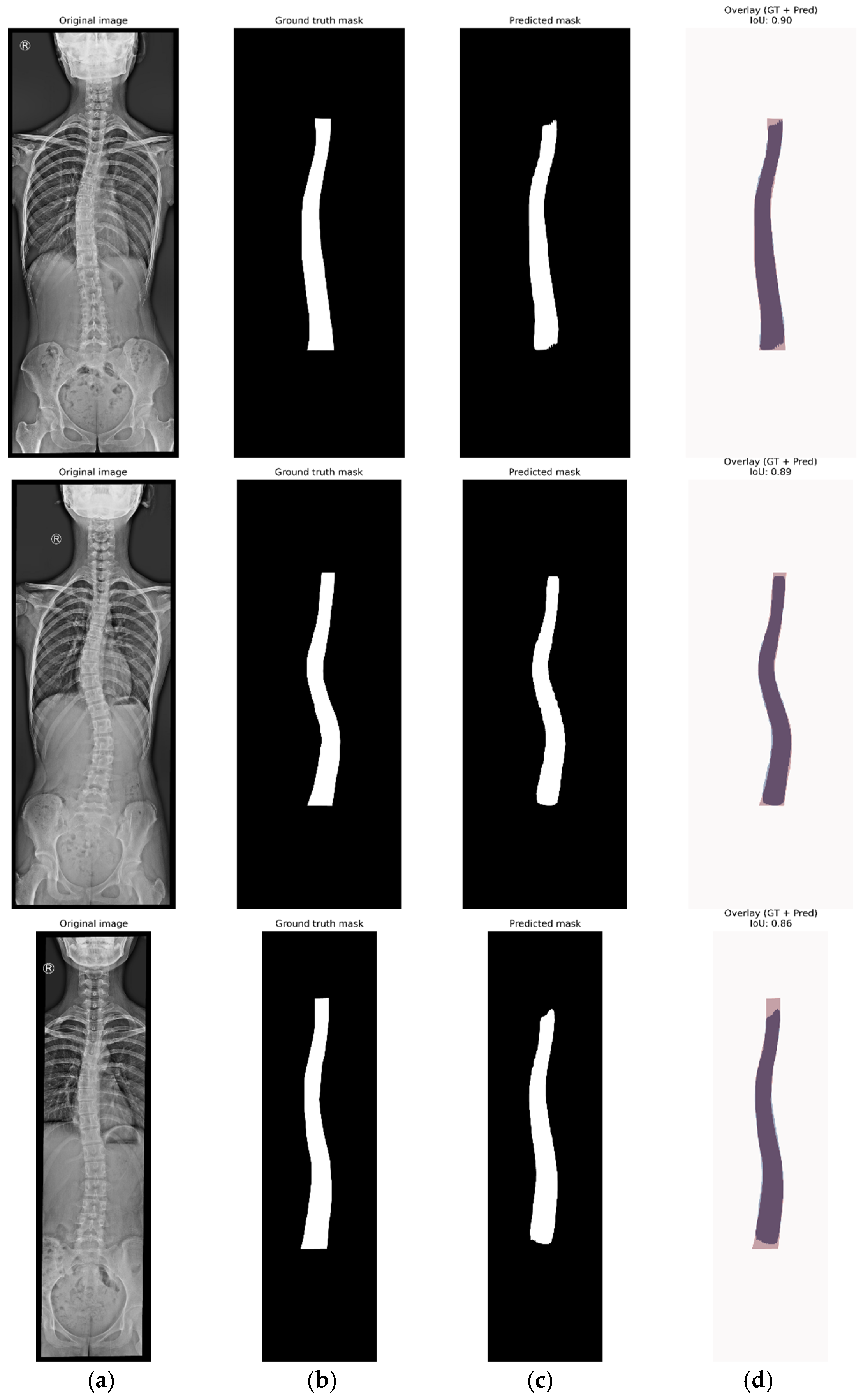 Diagnostics 15 01066 g005