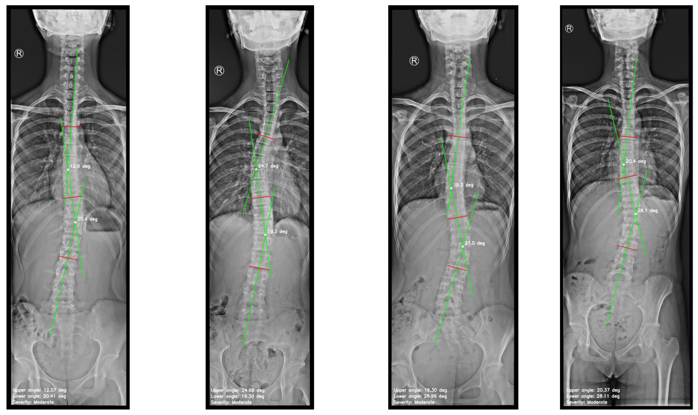 Diagnostics 15 01066 g009a