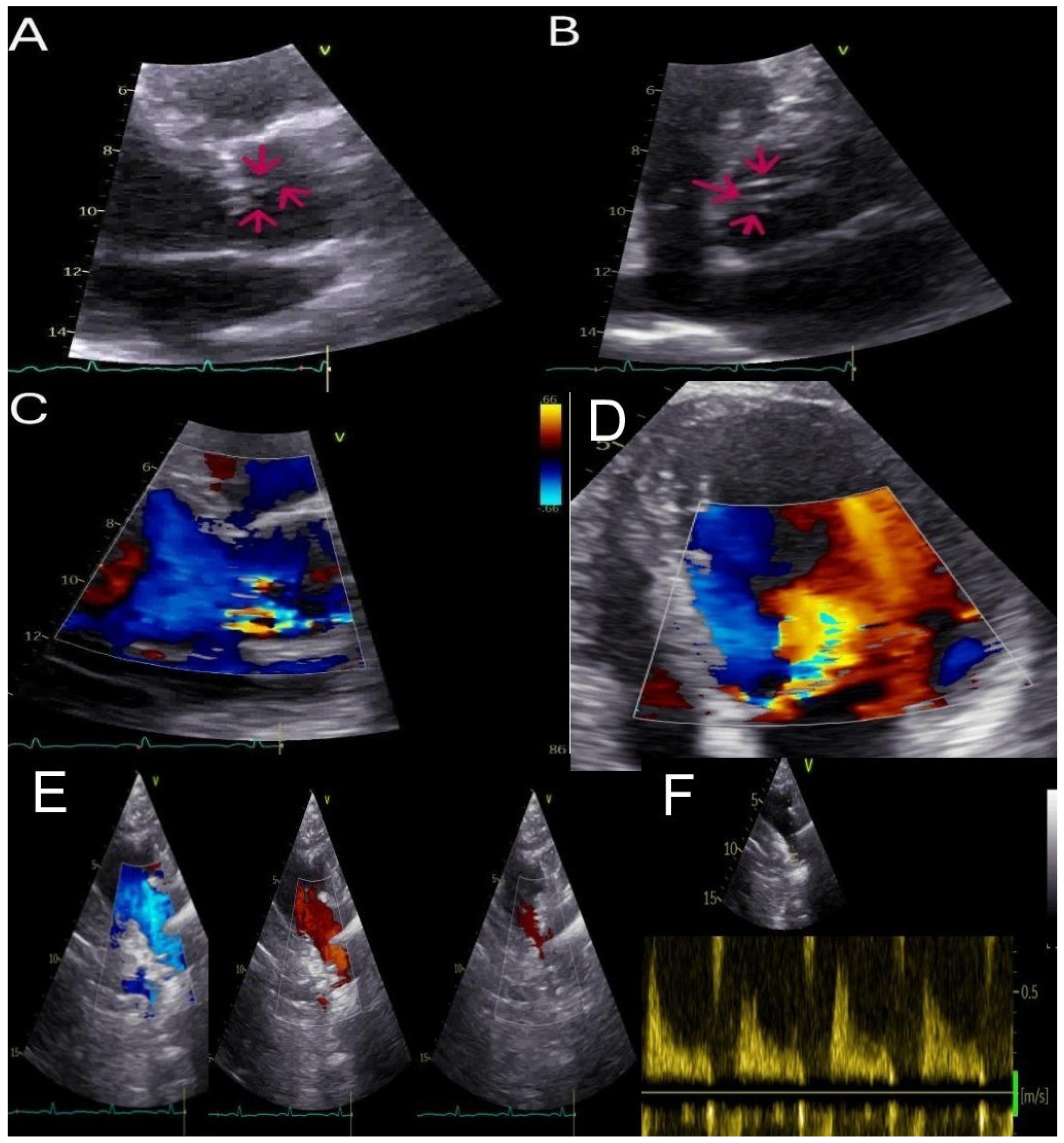 Diagnostics 15 01071 g001