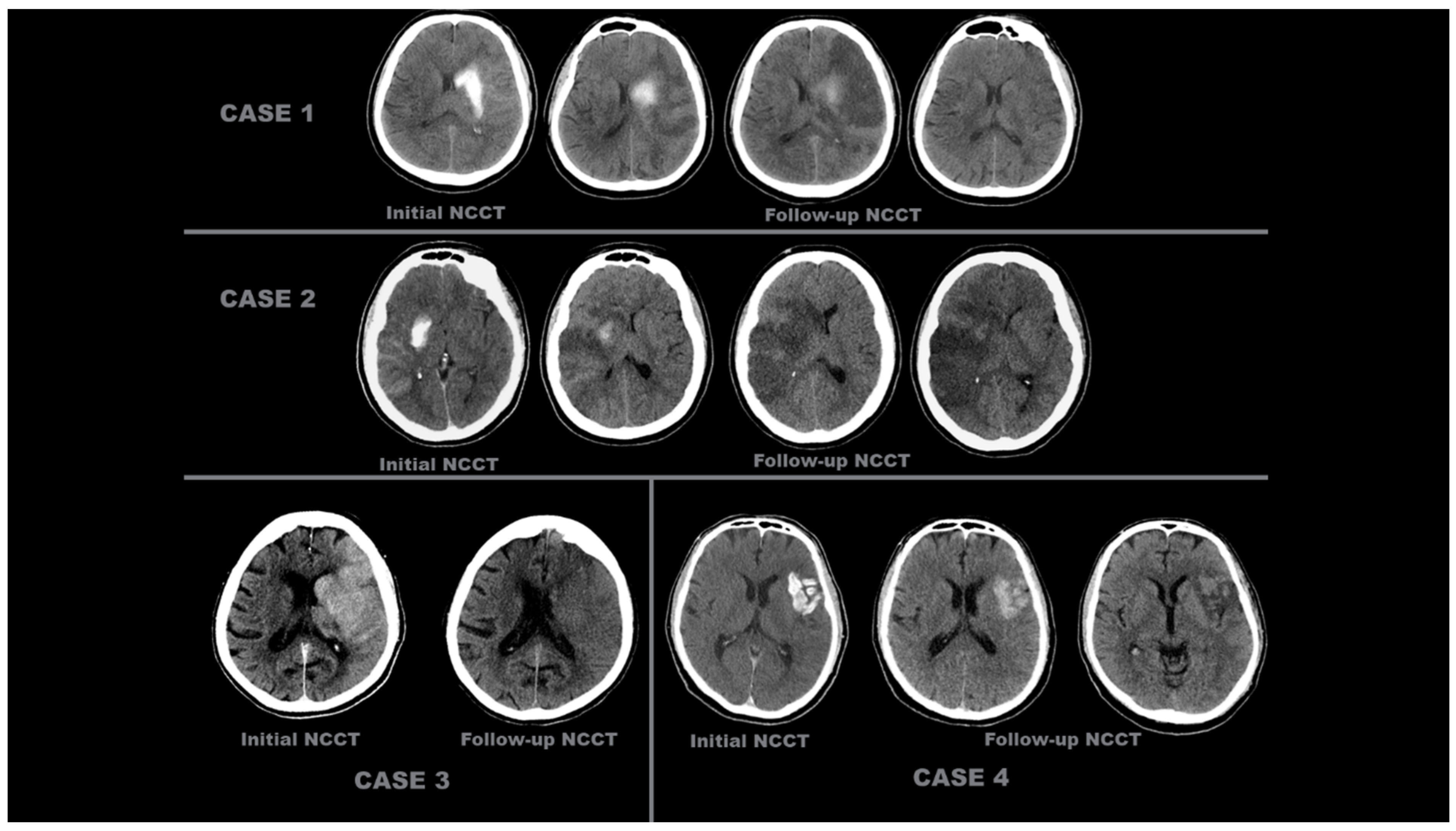 Diagnostics 15 01080 g002
