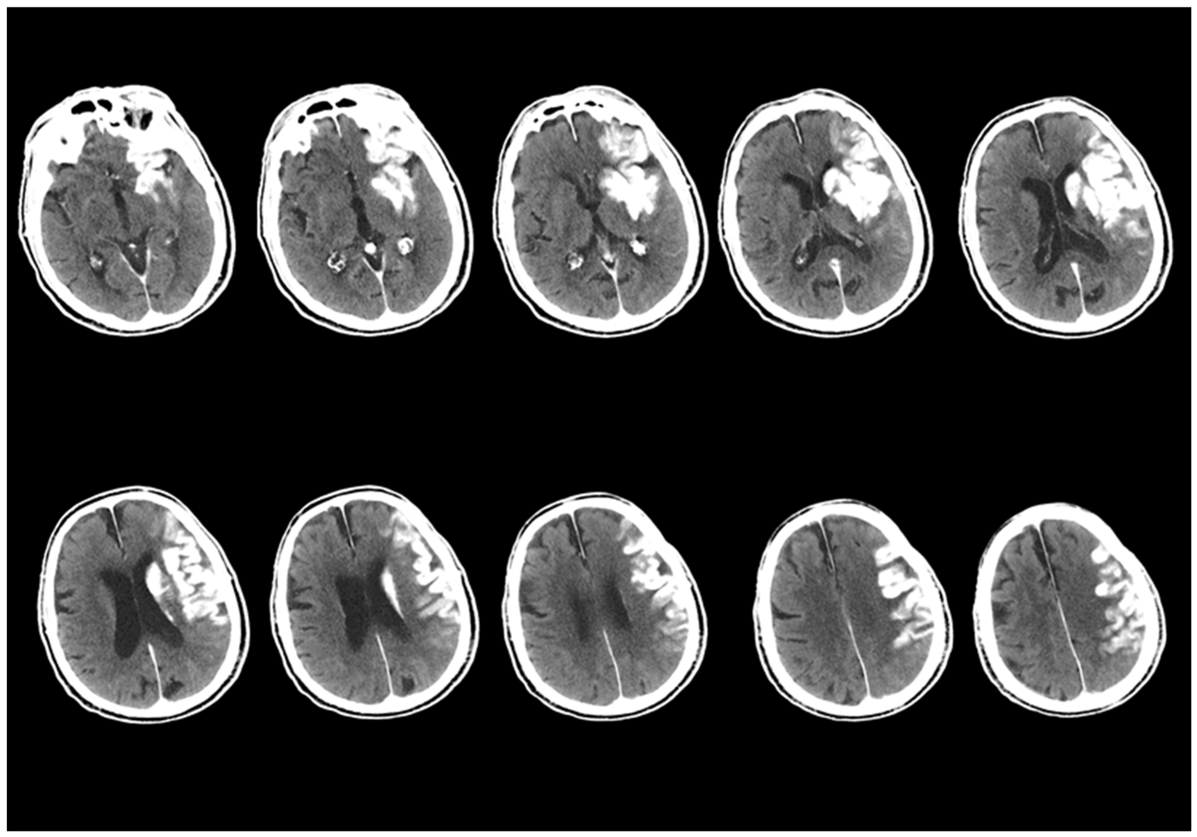 Diagnostics 15 01080 g004