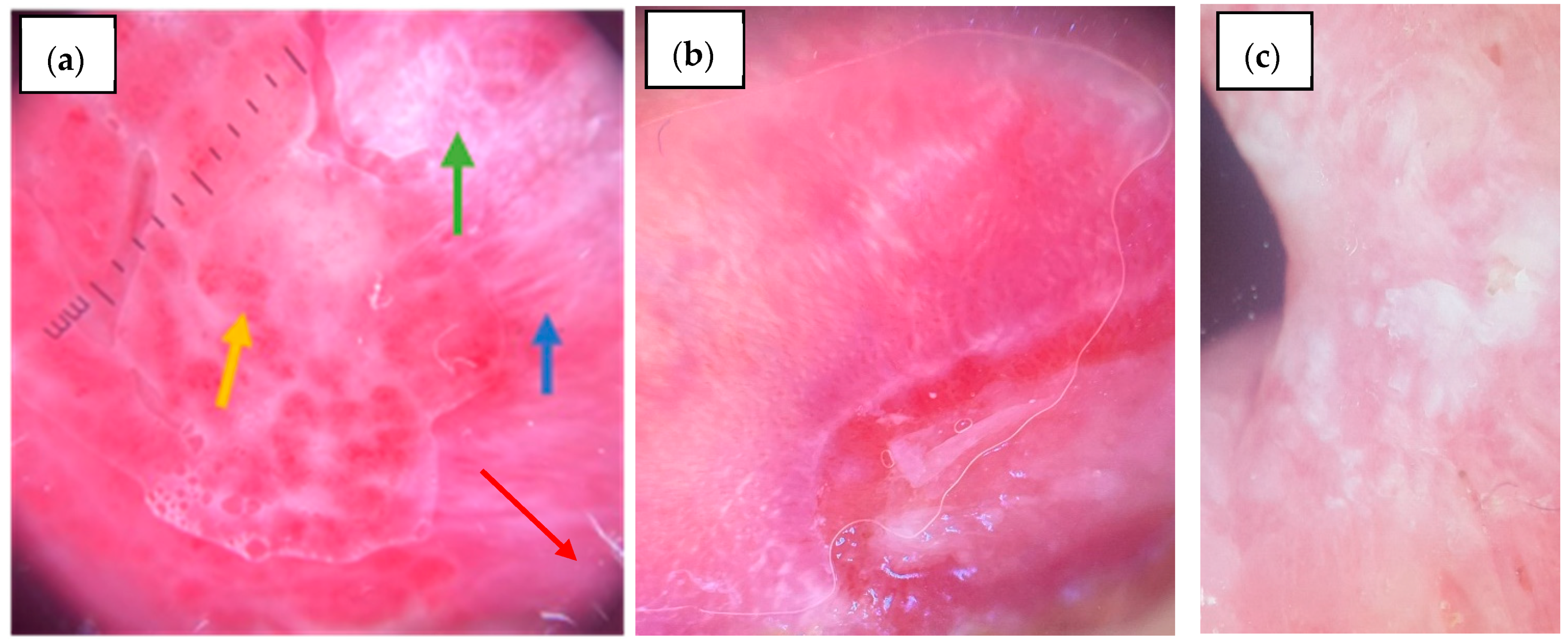 Diagnostics 15 01084 g003