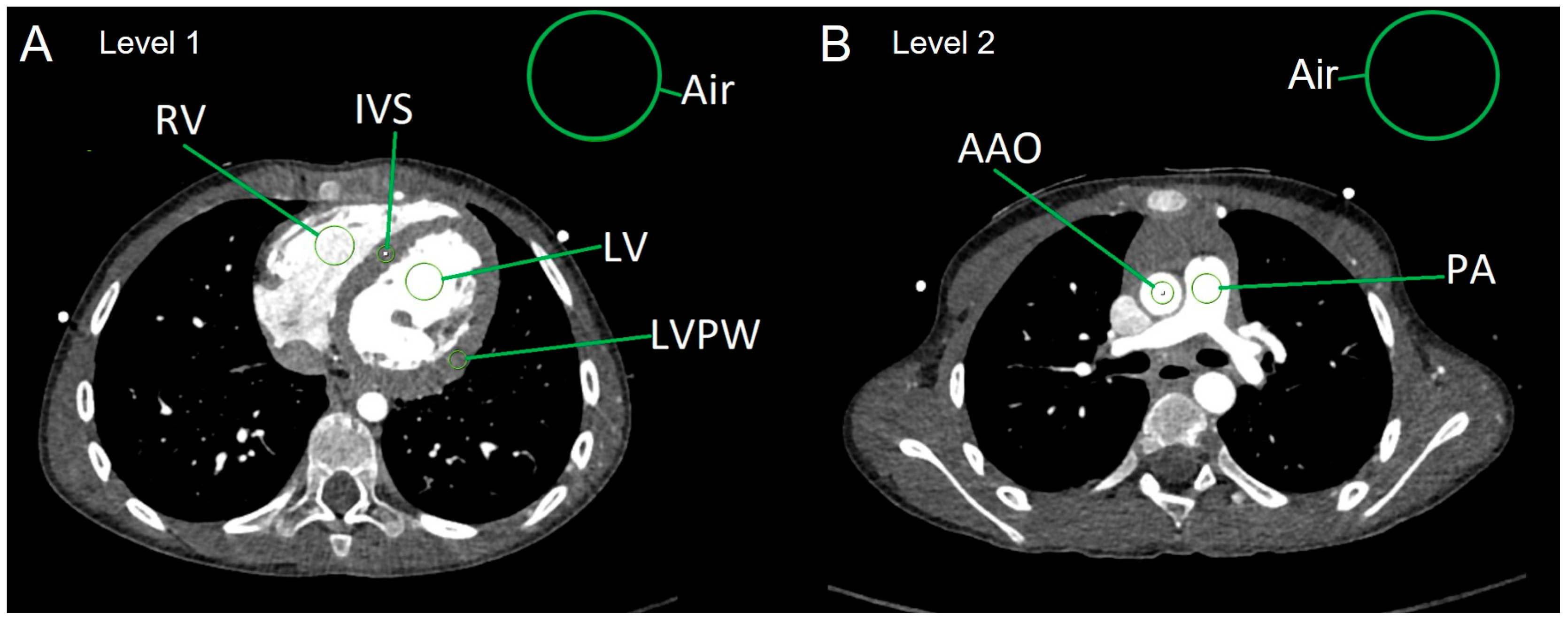 Diagnostics 15 01103 g001 Diagnostics 15 01103 g001