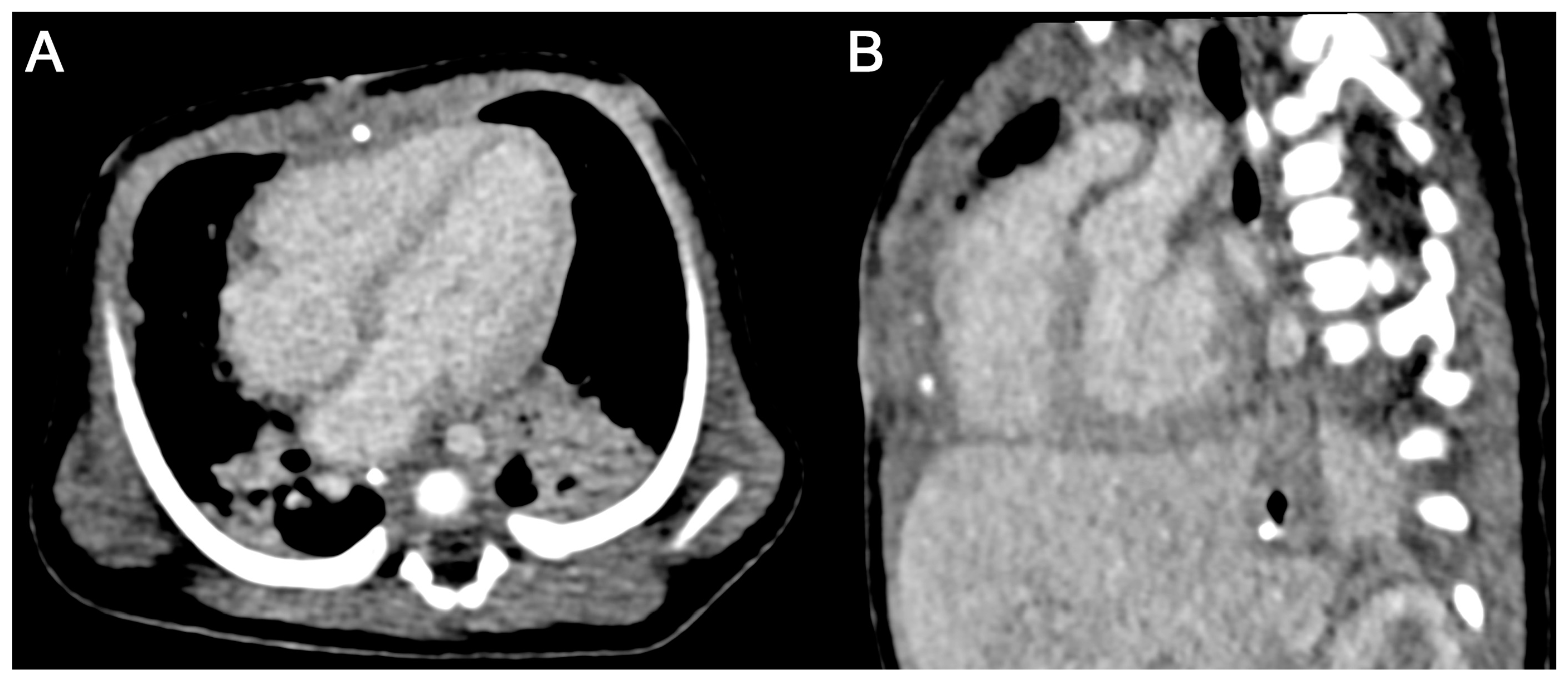 Diagnostics 15 01103 g004 Diagnostics 15 01103 g004