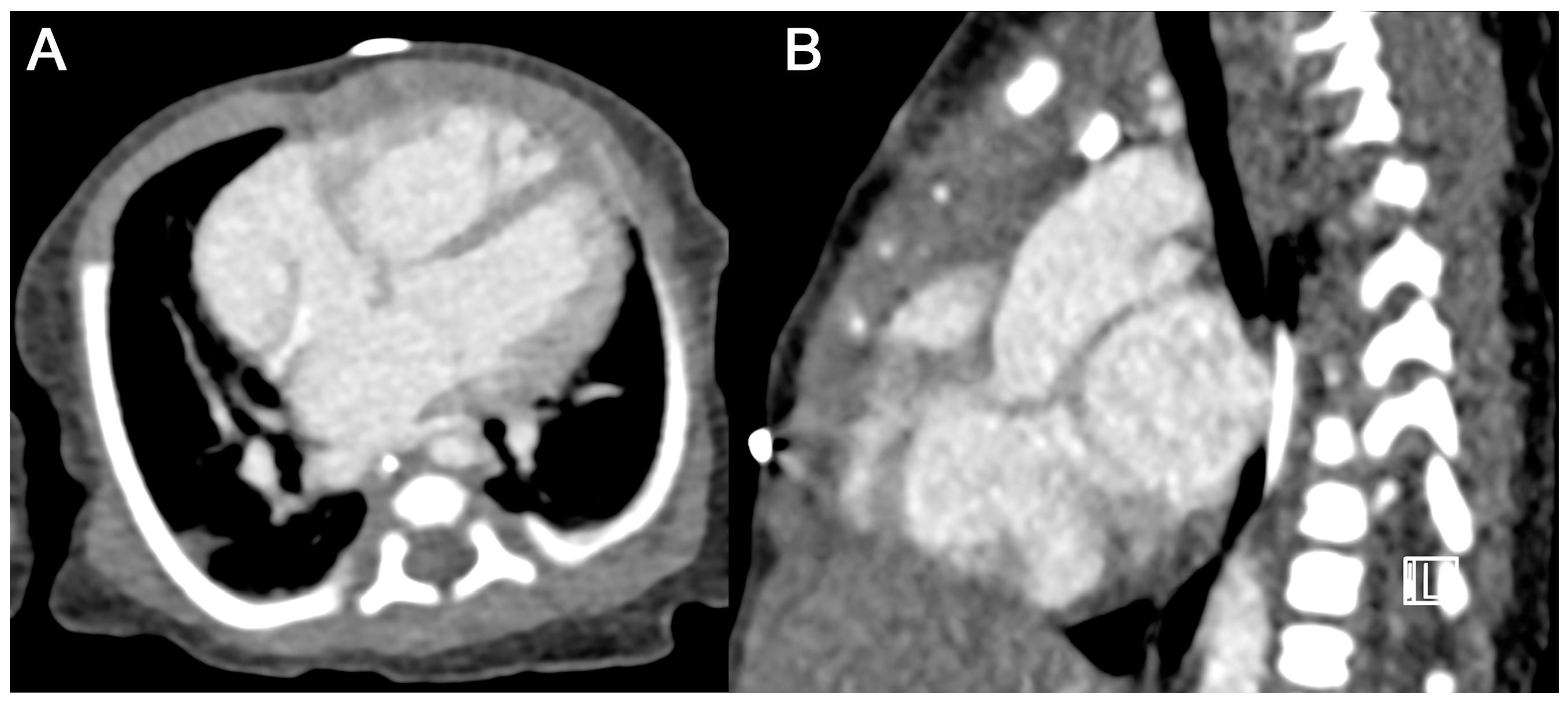 Diagnostics 15 01103 g005 Diagnostics 15 01103 g005