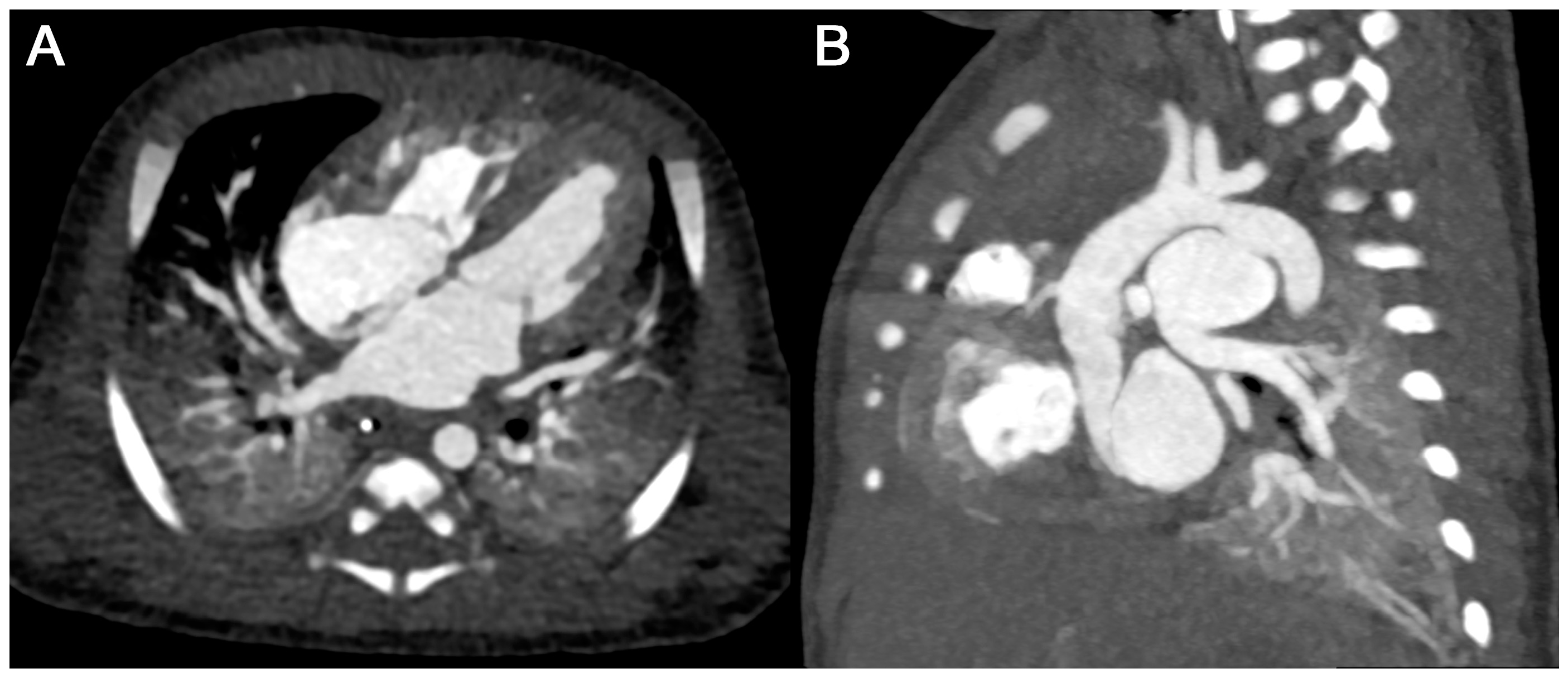 Diagnostics 15 01103 g006 Diagnostics 15 01103 g006