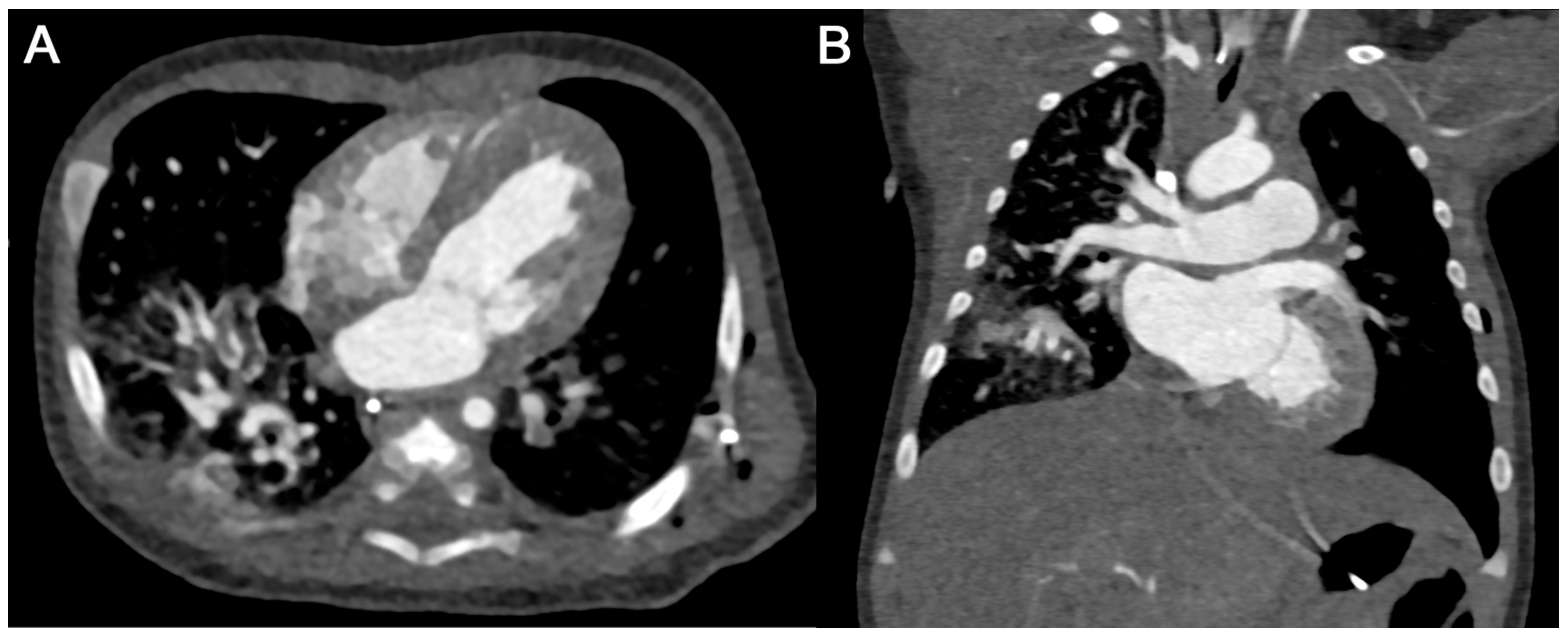 Diagnostics 15 01103 g007 Diagnostics 15 01103 g007