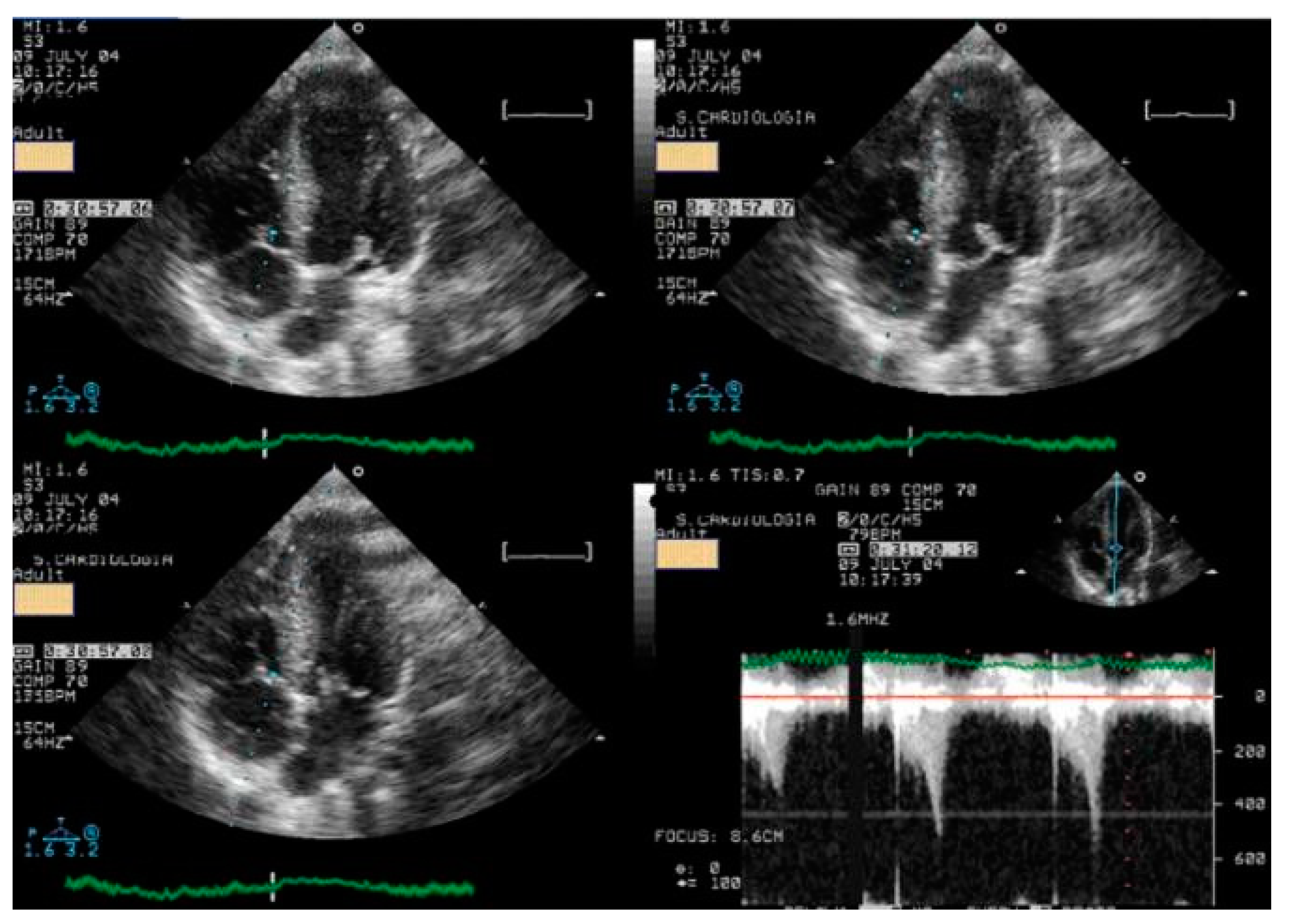 Diagnostics 15 01106 g005