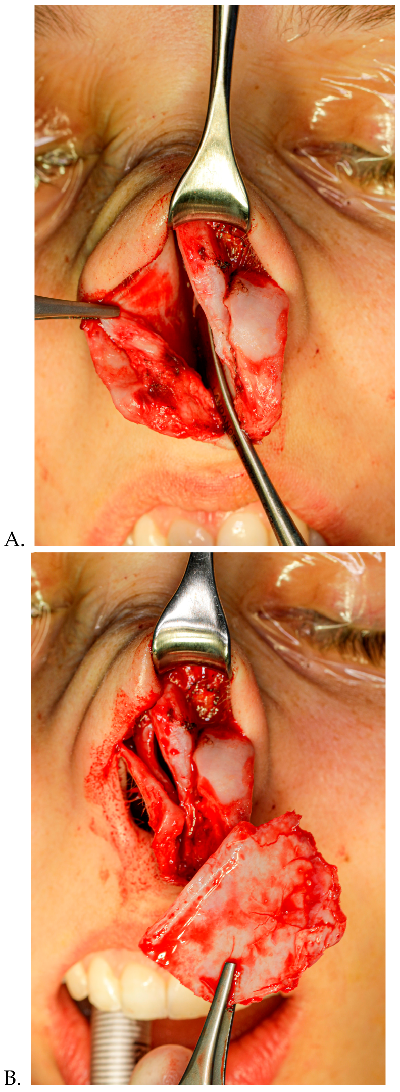 Diagnostics 15 01121 g003a