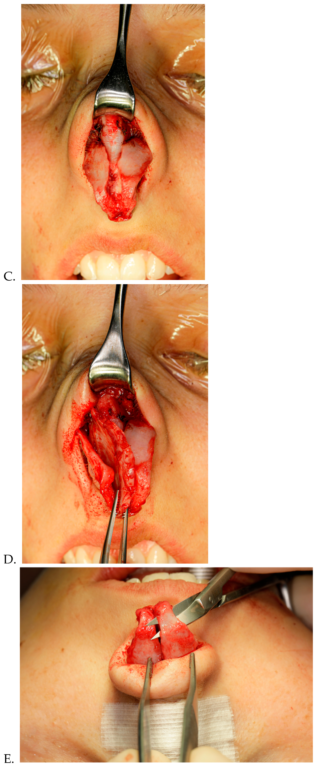 Diagnostics 15 01121 g003b