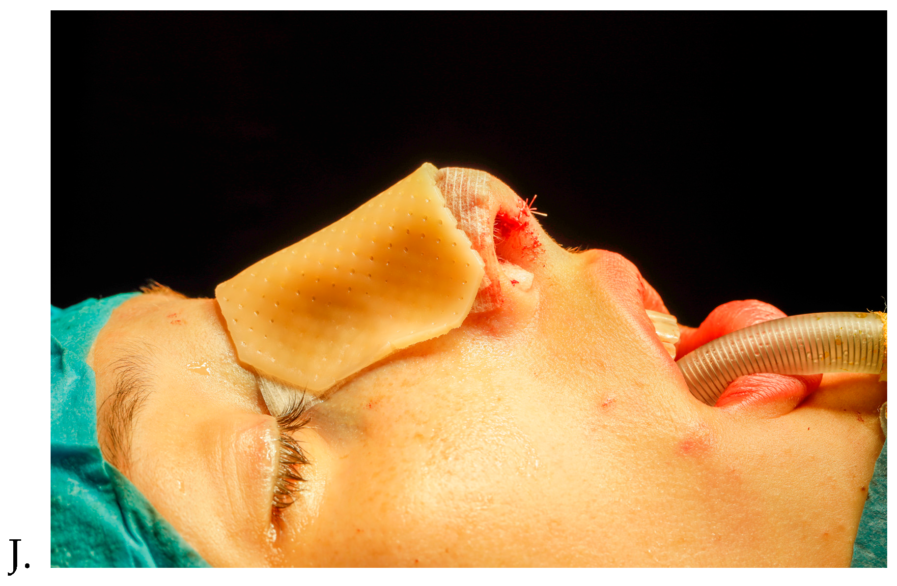 Diagnostics 15 01121 g003d