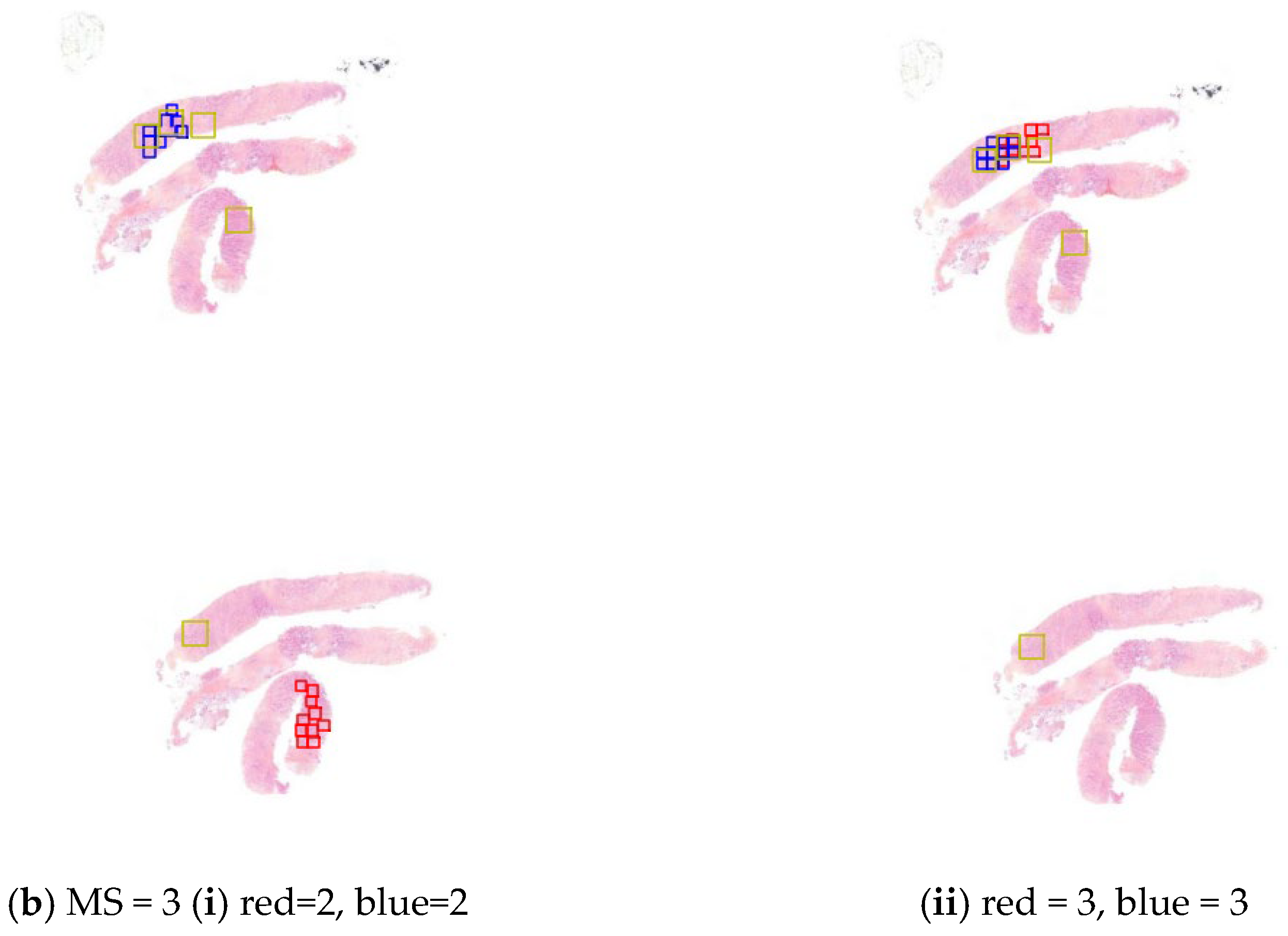Diagnostics 15 01127 g004b
