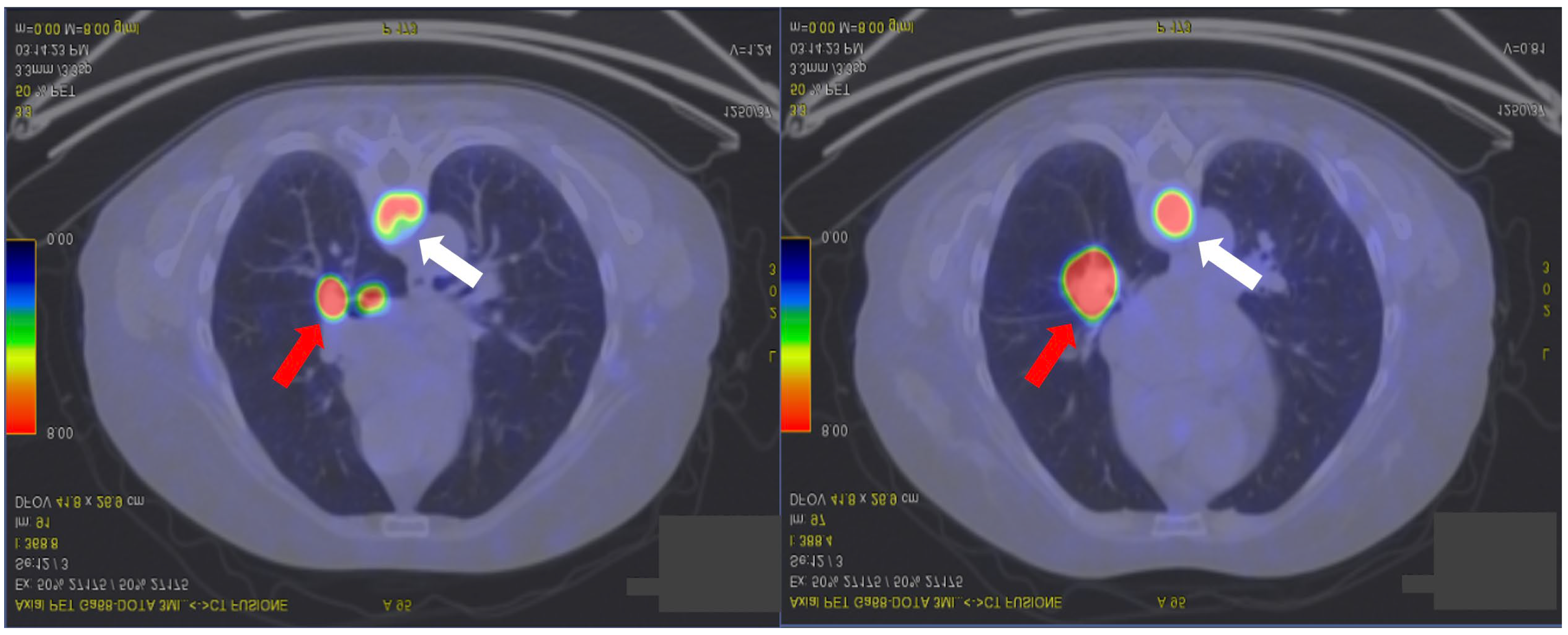 Diagnostics 15 01128 g002 Diagnostics 15 01128 g002