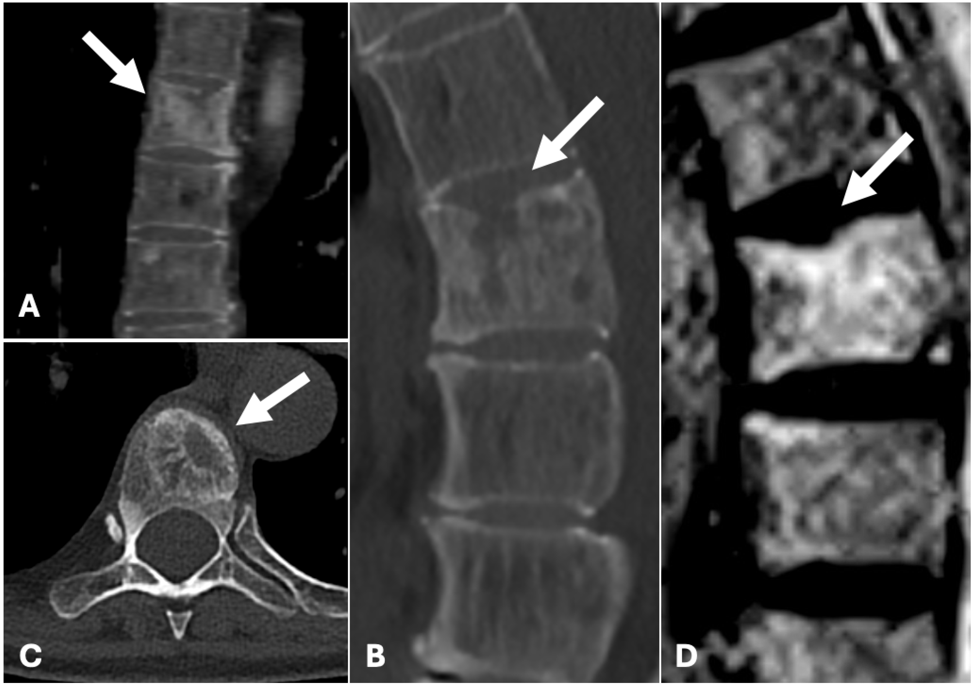 Diagnostics 15 01128 g004 Diagnostics 15 01128 g004