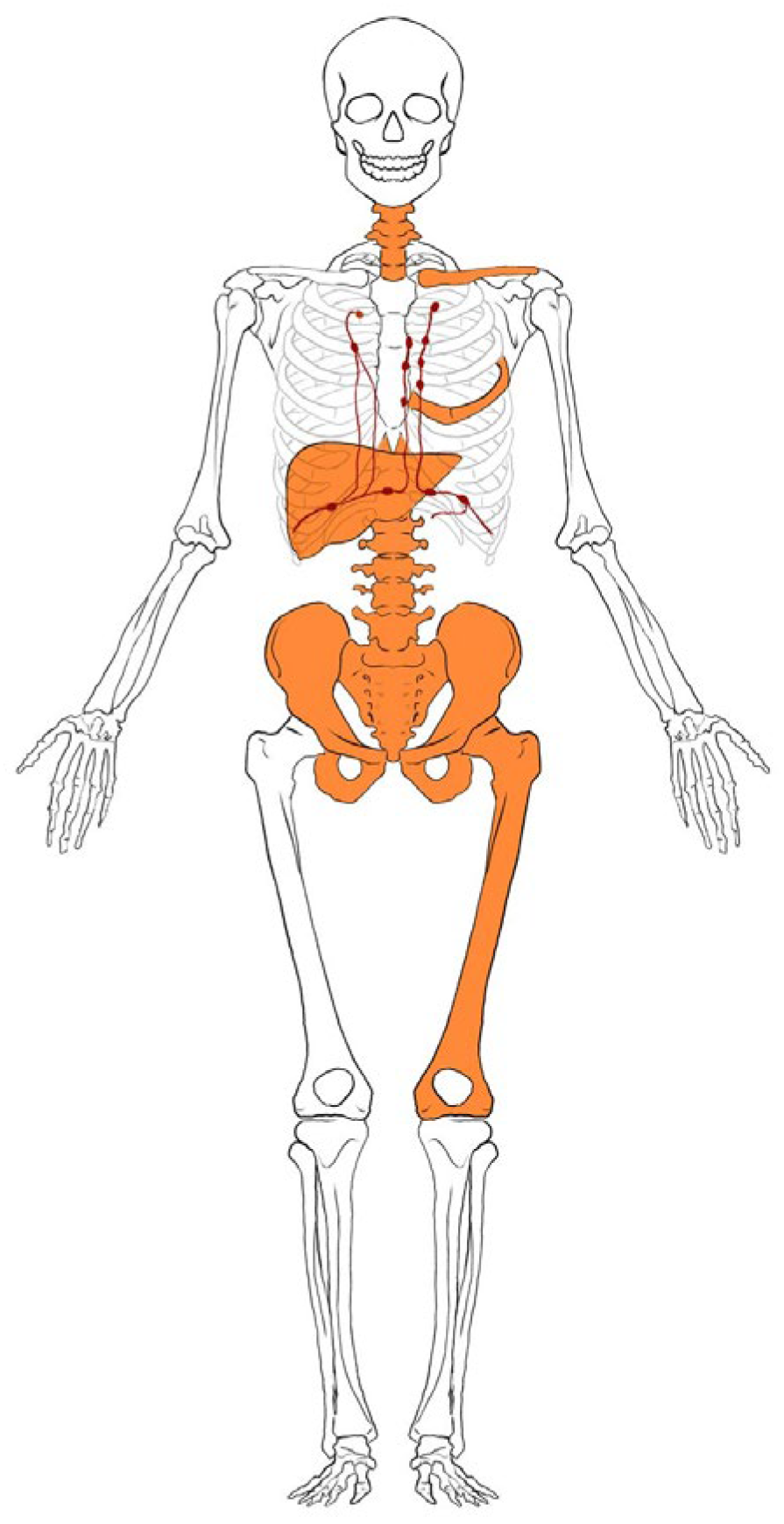 Diagnostics 15 01128 g006 Diagnostics 15 01128 g006