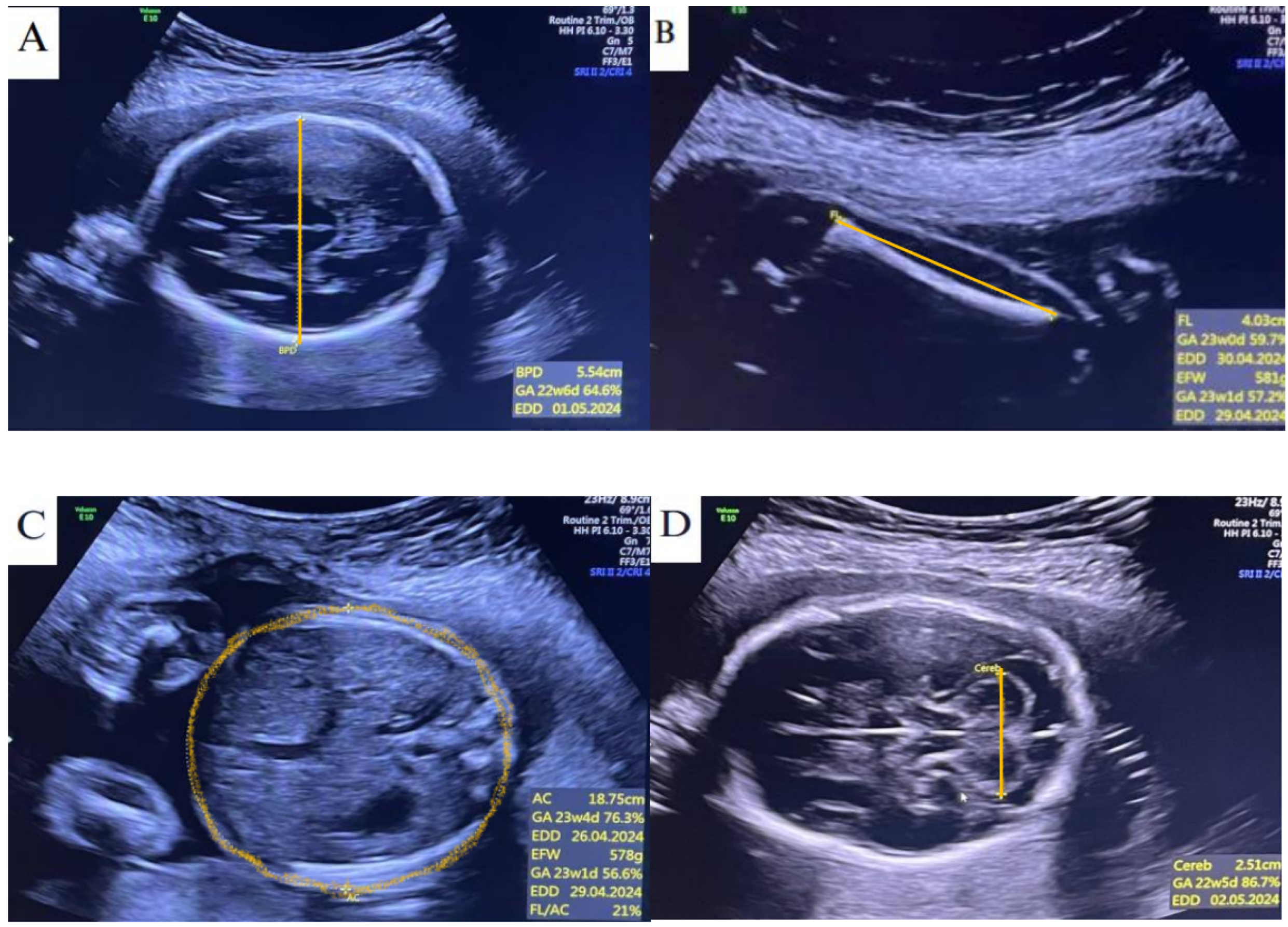Diagnostics 15 01130 g002