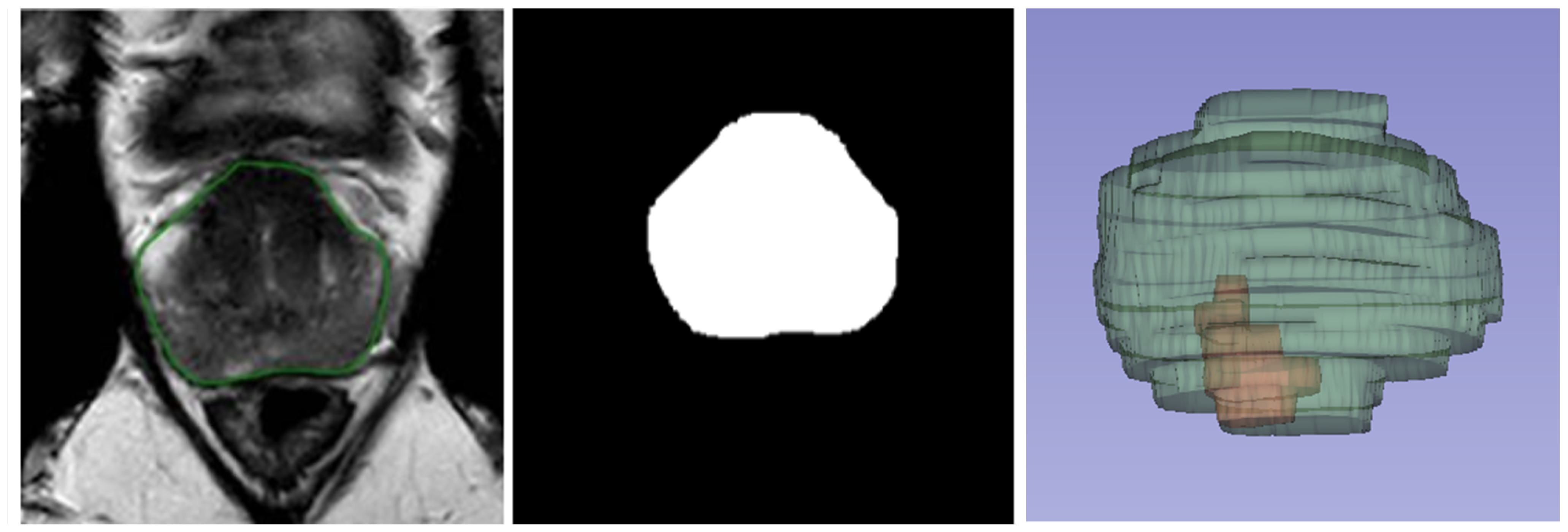 Diagnostics 15 01141 g001