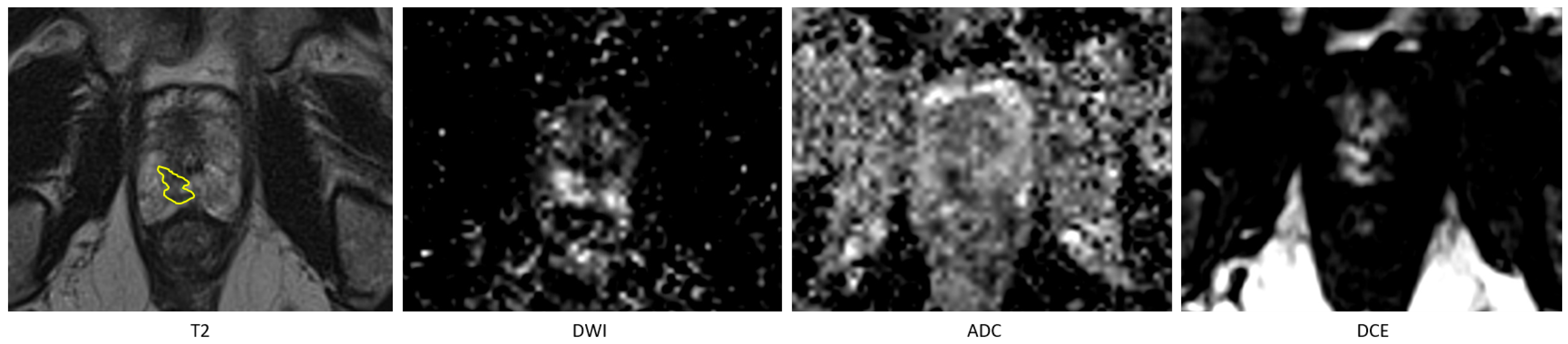 Diagnostics 15 01141 g002