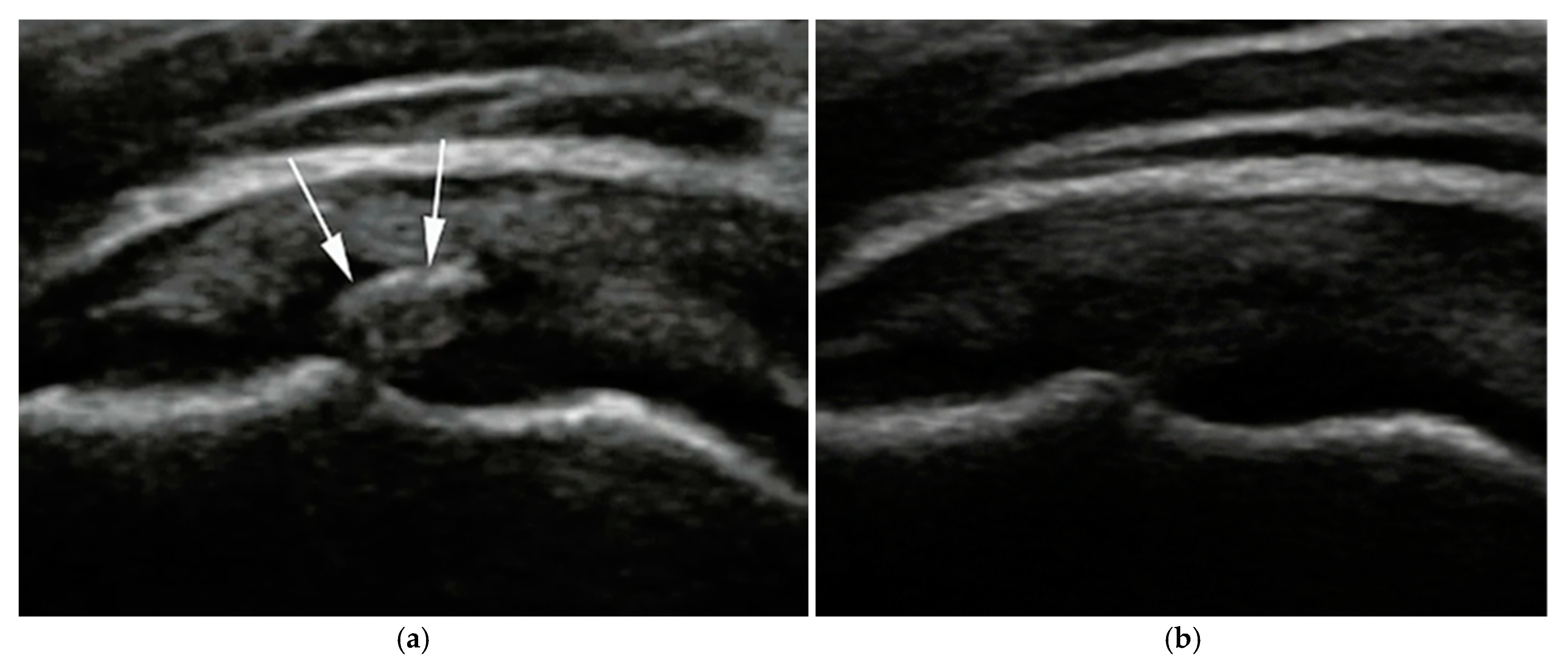 Diagnostics 15 01142 g003