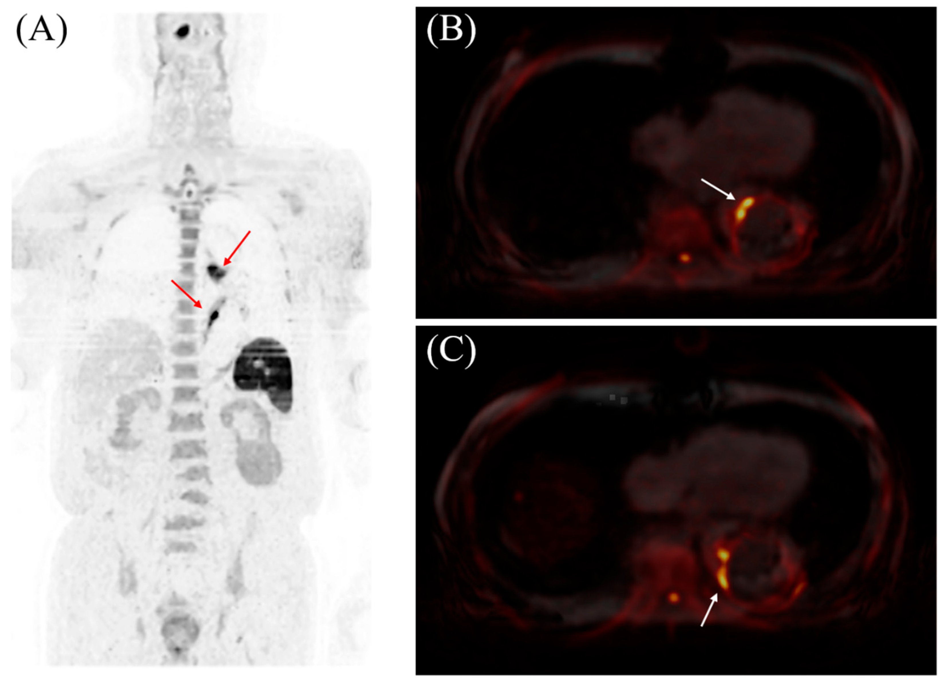 Diagnostics 15 01151 g001
