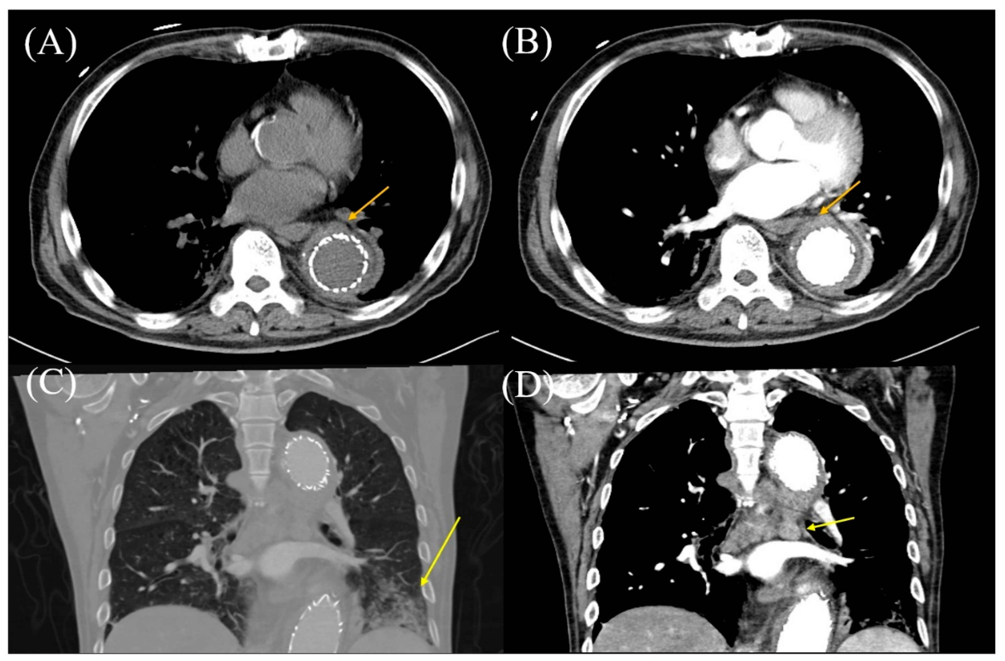 Diagnostics 15 01151 g002